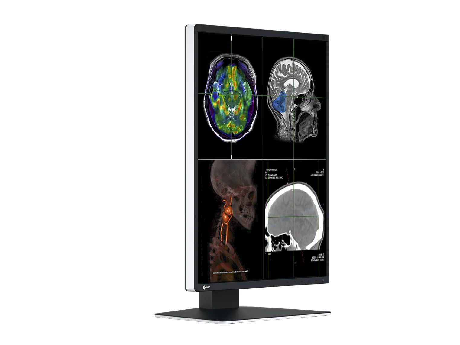 Eizo RadiForce RX370 3MP 21" Color General Radiology Diagnostic PACS Display (RX370) - Image 5