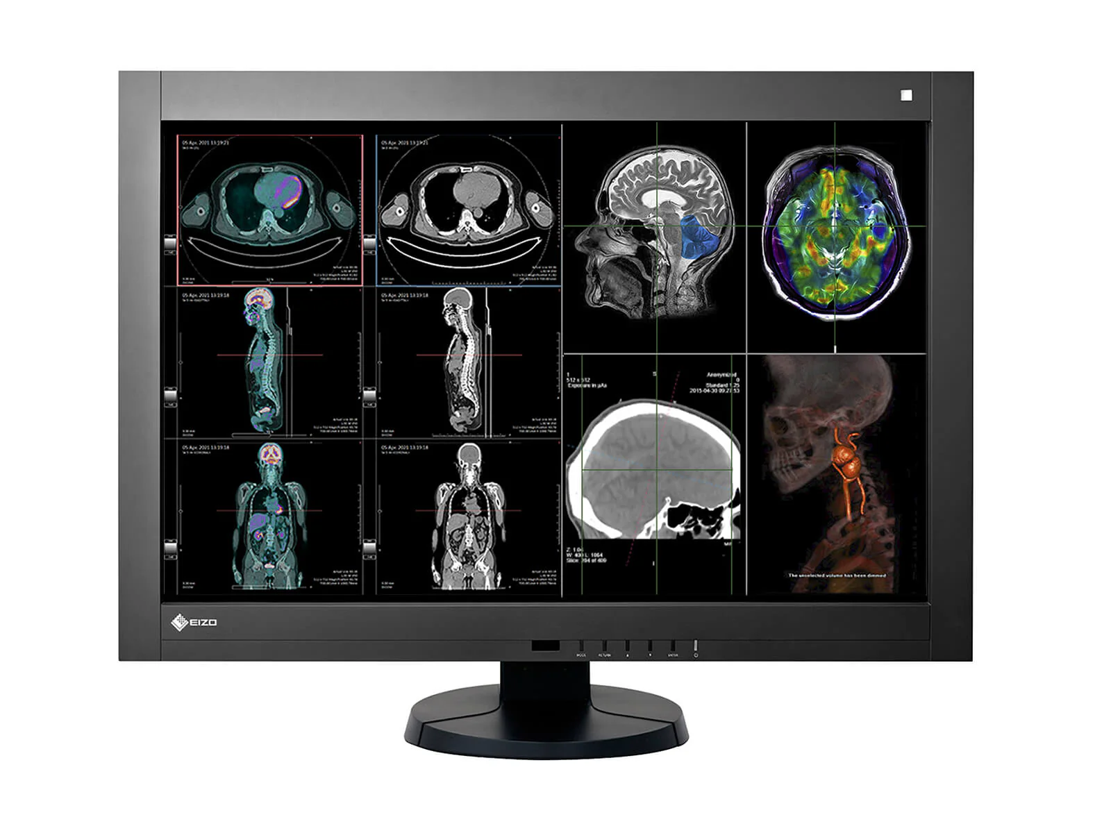 Eizo RadiForce RX440 4MP 30" Color General Radiology PACS Display (RX440-BK)
