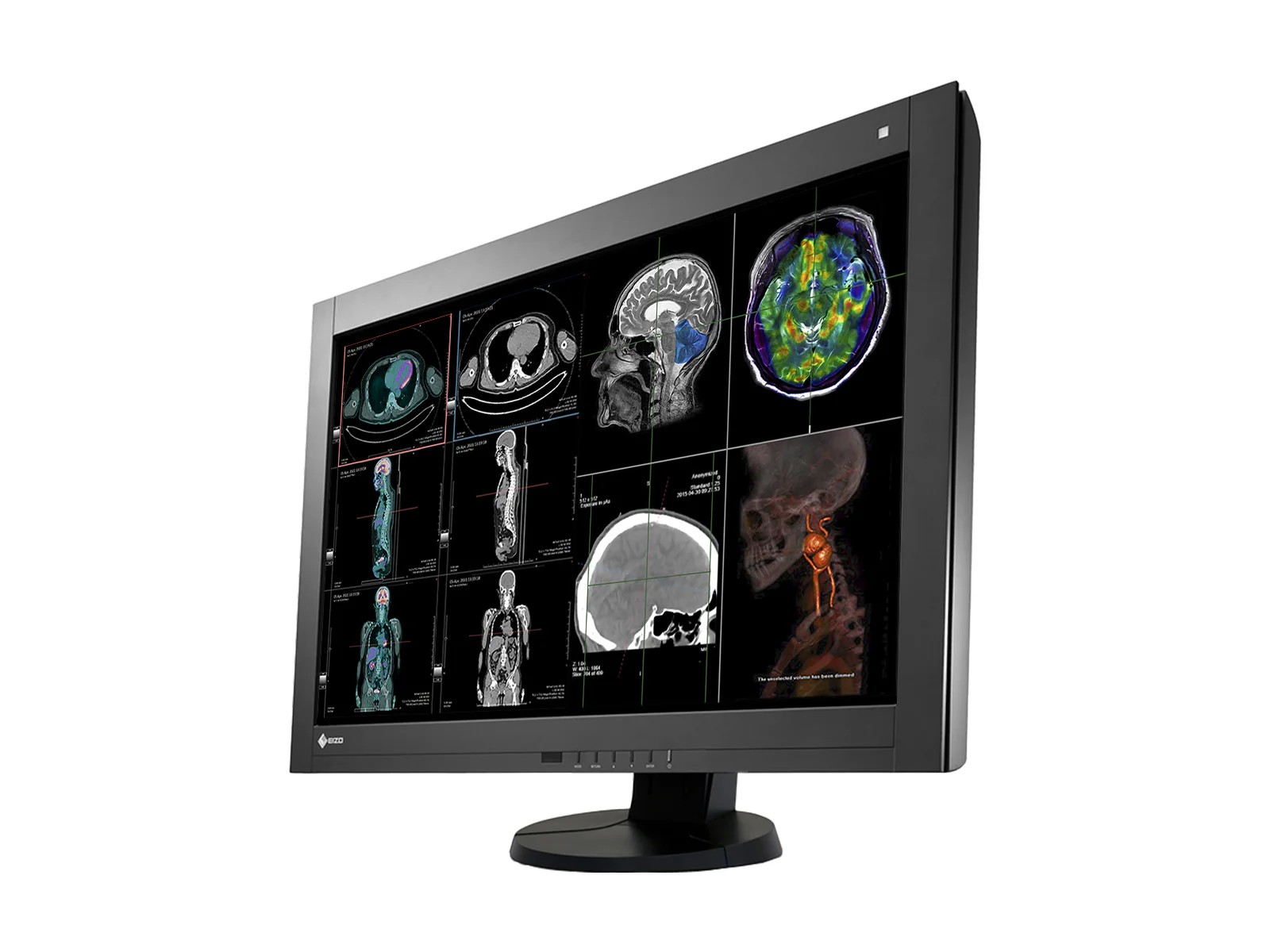Eizo RadiForce RX440 4MP 30" Color General Radiology PACS Display (RX440-BK) - Image 2