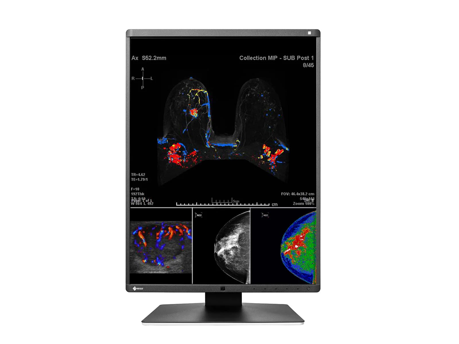 Eizo RadiForce RX560 5MP 21" Color Mammo 3D-DBT Breast Imaging Display (RX560-BK) - Image 3