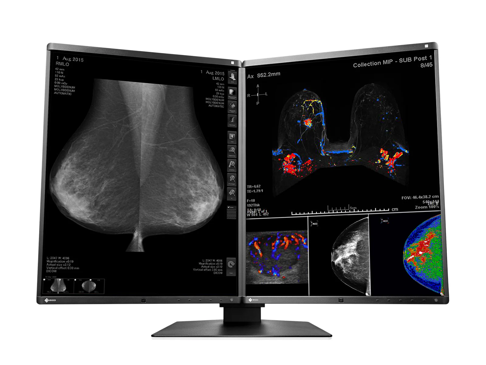 Eizo RadiForce RX560 5MP 21" Color Mammo 3D-DBT Breast Imaging Display (RX560-BK) - Image 4