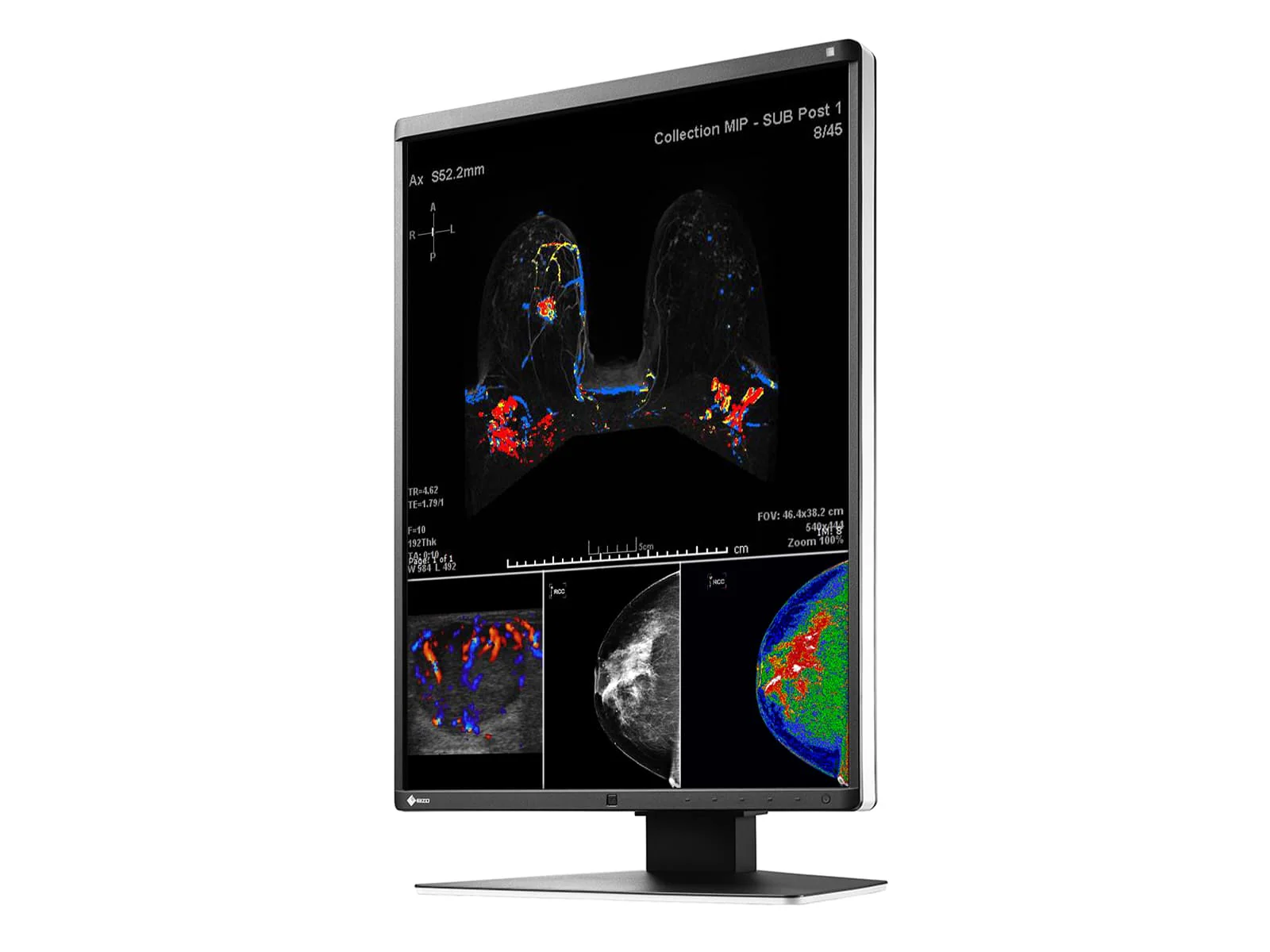 Eizo RadiForce RX560 5MP 21" Color Mammo 3D-DBT Breast Imaging Display (RX560-BK) - Image 5