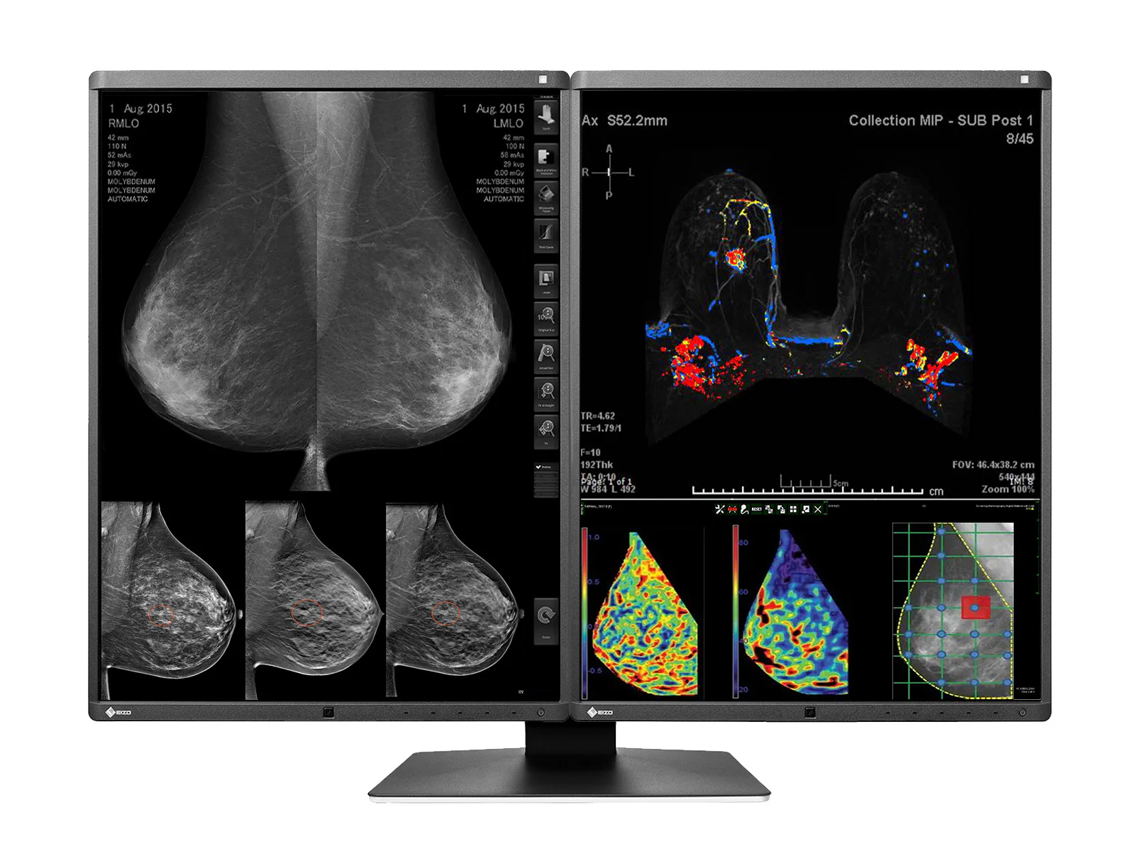 Eizo RadiForce RX570 5MP 21" Color Mammo 3D-DBT Breast Imaging Display (RX570-BK)
