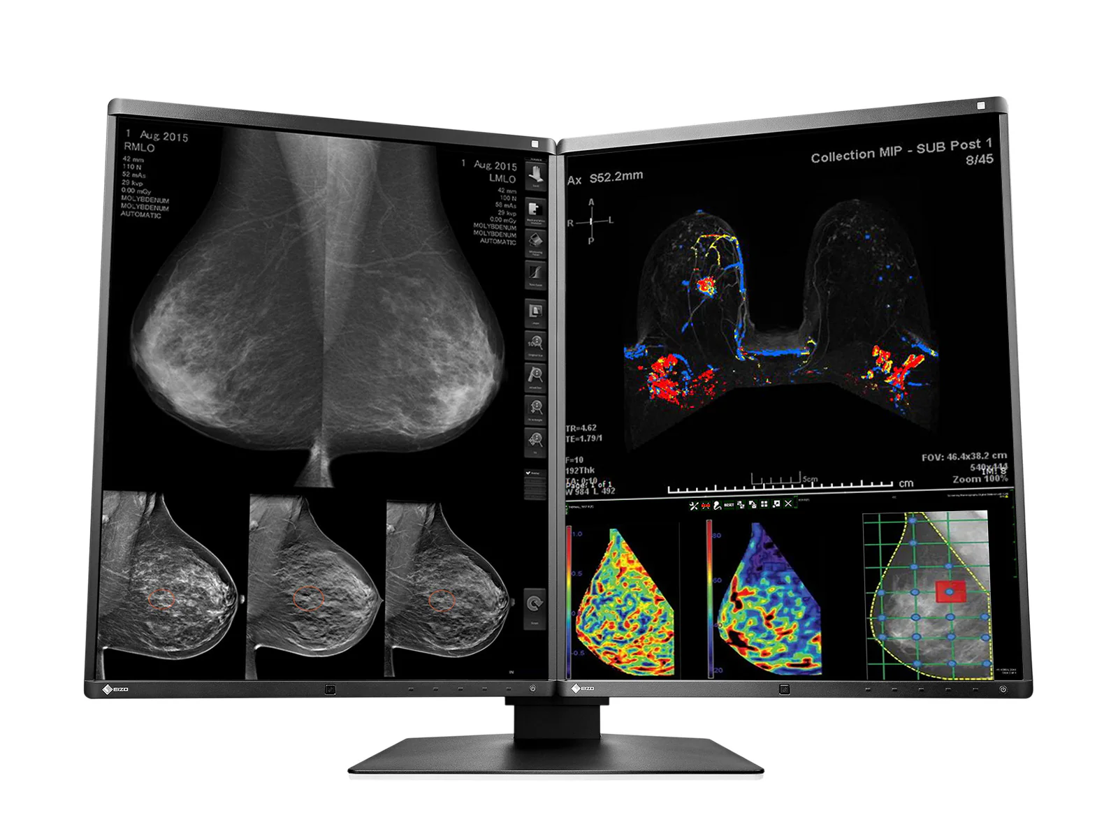 Eizo RadiForce RX570 5MP 21" Color Mammo 3D-DBT Breast Imaging Display (RX570-BK) - Image 2