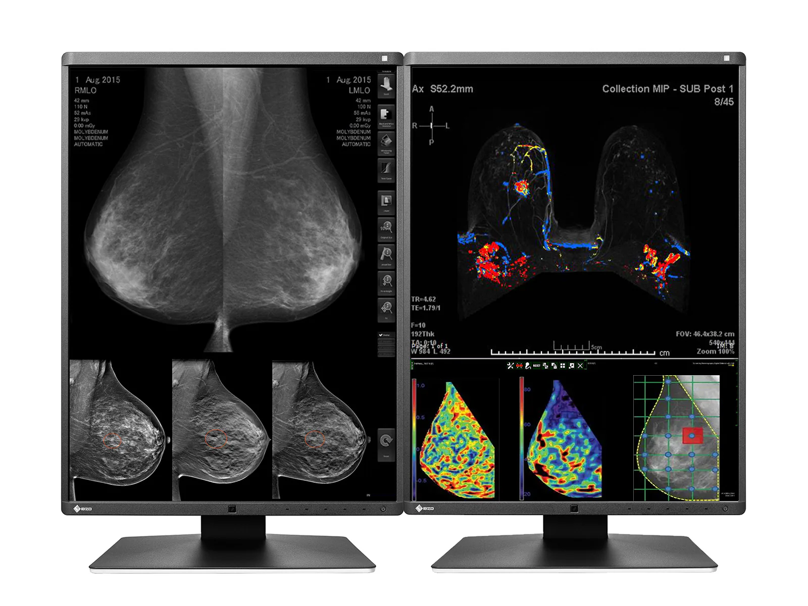 Eizo RadiForce RX570 5MP 21" Color Mammo 3D-DBT Breast Imaging Display (RX570-BK) - Image 3