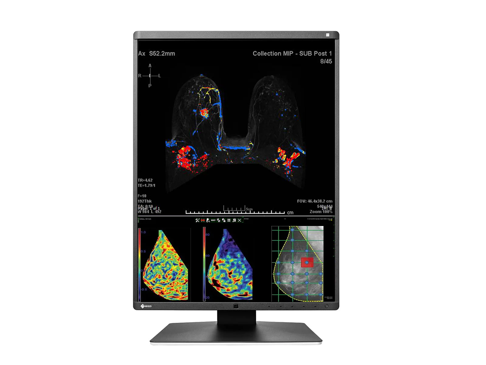 Eizo RadiForce RX570 5MP 21" Color Mammo 3D-DBT Breast Imaging Display (RX570-BK) - Image 4