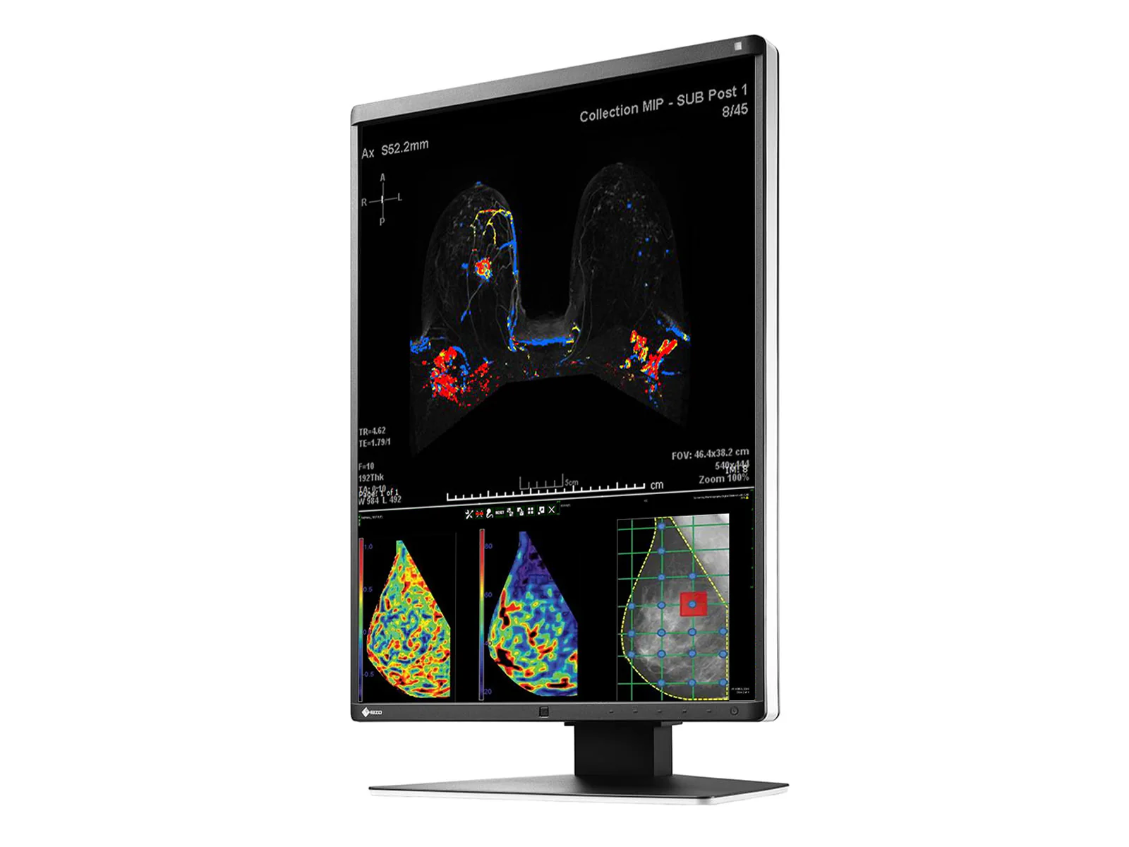 Eizo RadiForce RX570 5MP 21" Color Mammo 3D-DBT Breast Imaging Display (RX570-BK) - Image 5