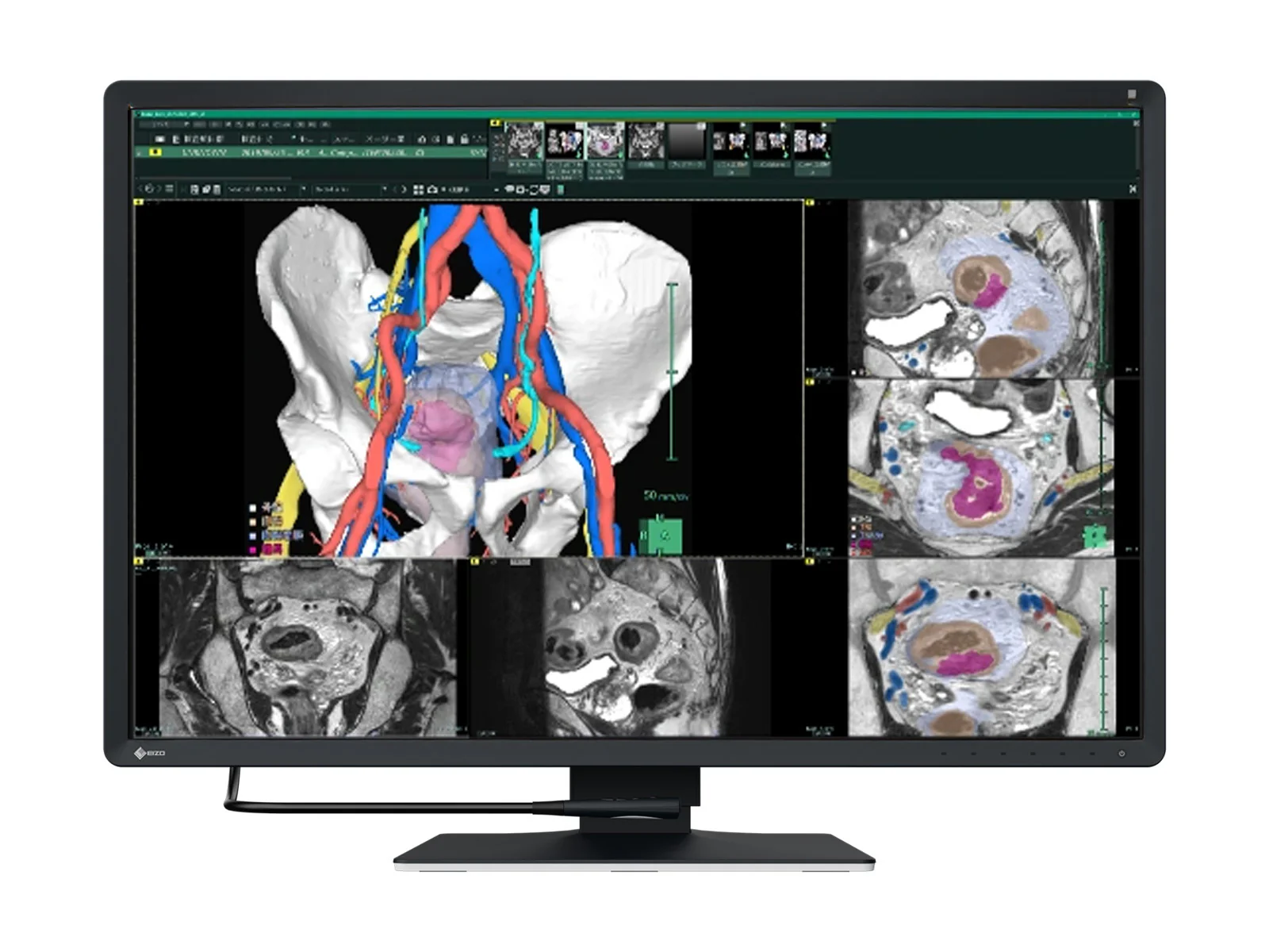 Eizo RadiForce RX670 6MP 30" Color General Radiology PACS Display (RX670)