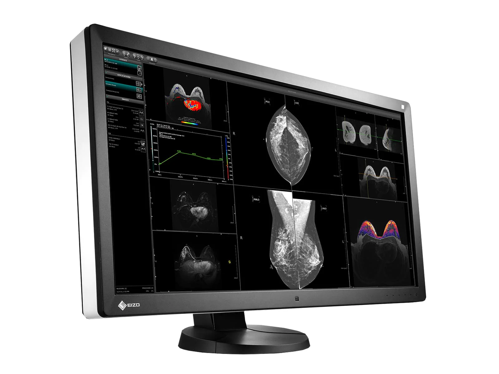 Eizo RadiForce RX850 8MP 31" Fusion Color Mammo 3D-DBT Breast Imaging Display (RX850-BK) - Image 2