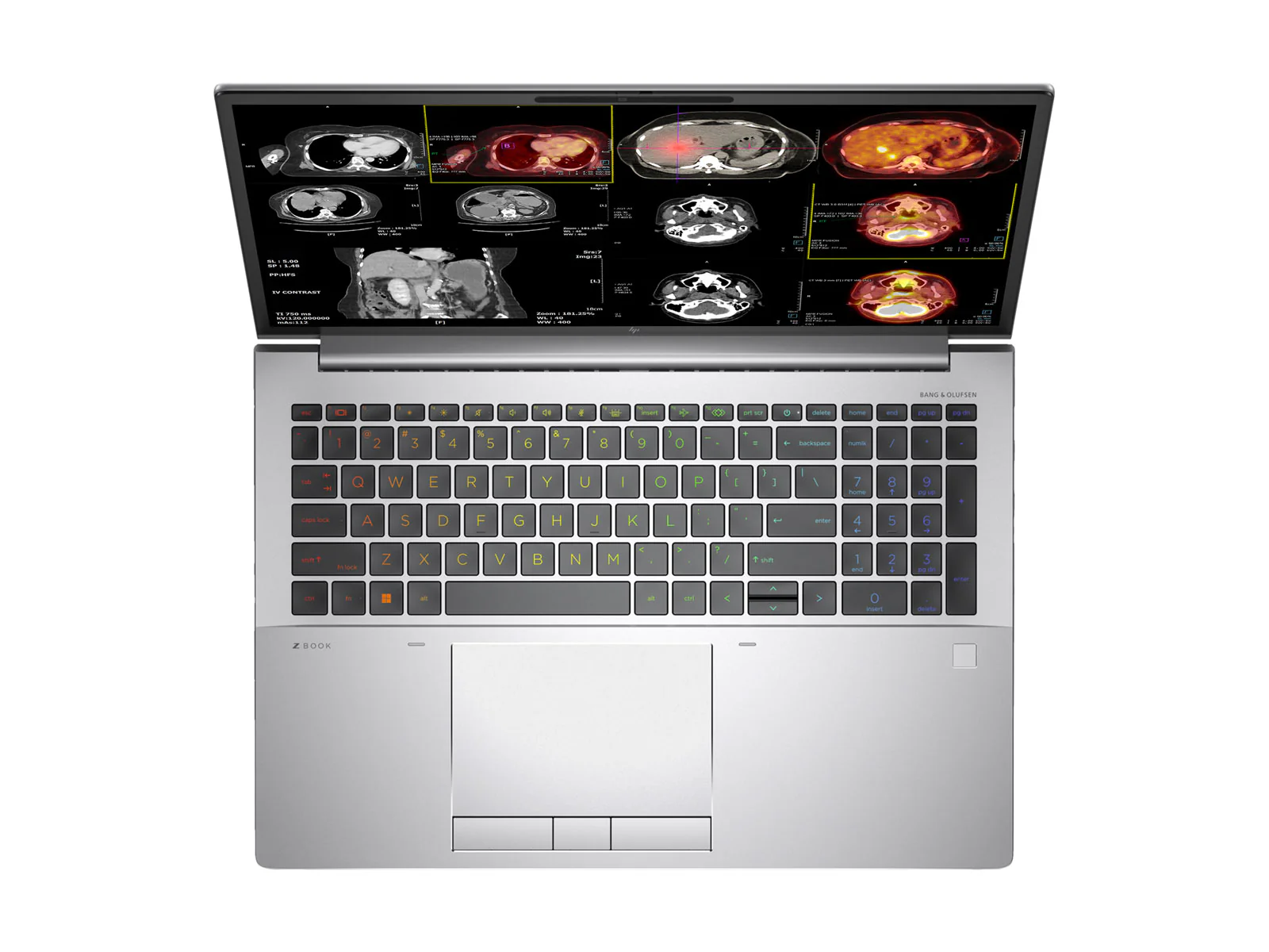 HP ZBook Fury 16 G10 Mobile Radiology Workstation | 16" 8MP 4K UHD DICOM Calibrated | Core i9-13950HX @ 5.5GHz | 128GB DDR5 | 1TB NVMe SSD | RTX 5000 Ada 16GB | WiFi 6E - Image 3