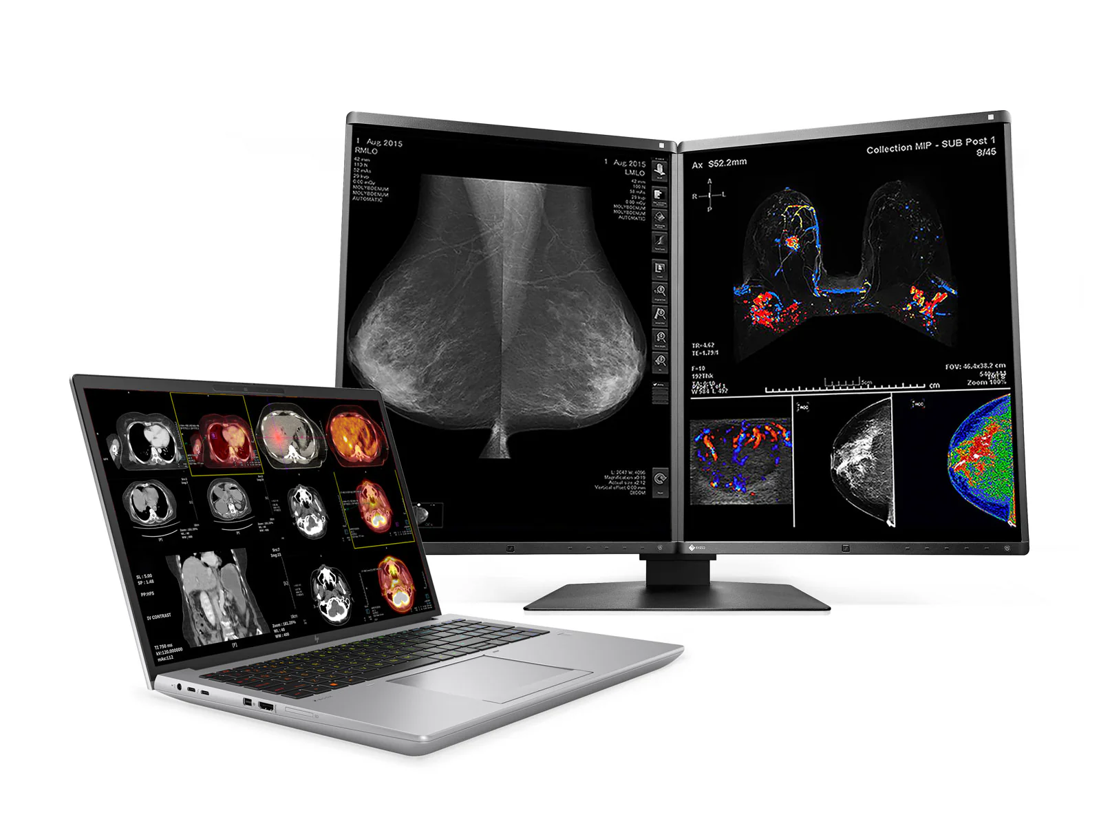 HP ZBook Fury 16 G10 Mobile Radiology Workstation | 16" 9MP 4K+ UHD DICOM Calibrated | Core i9-13950HX @ 5.5GHz | 32GB DDR5 | 1TB NVMe SSD | RTX 5000 Ada 16GB | WiFi 6E - Image 3
