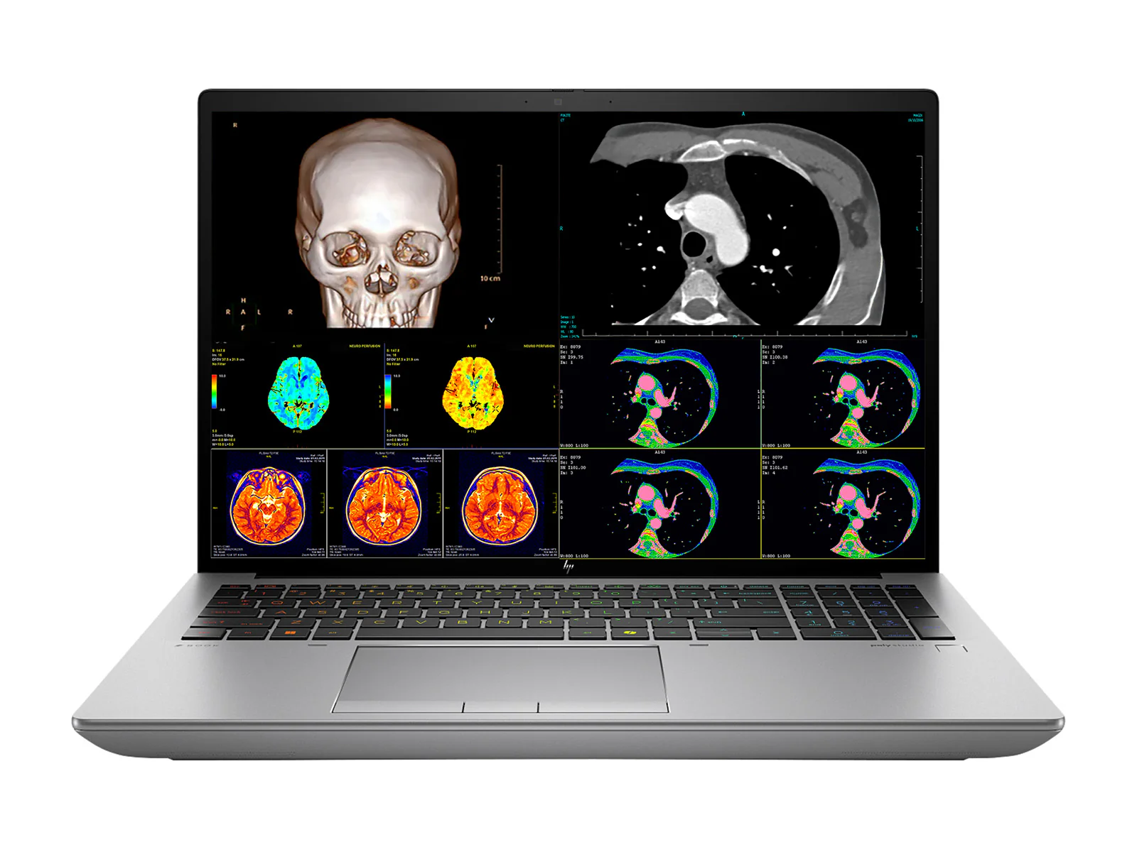 HP ZBook Fury 16 G11 Mobile Radiology Workstation | 16" OLED 9MP 4K+ UHD DICOM Calibrated | Core i9-14900HX @ 5.8GHz | 24-Core | 128GB DDR5 | 1TB NVMe SSD | RTX 2000 Ada 8GB | WiFi 6E