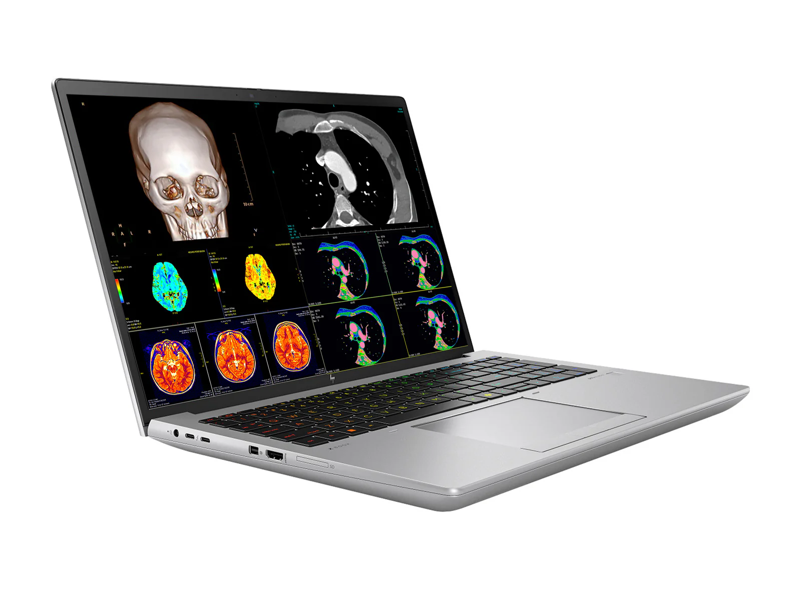 HP ZBook Fury 16 G11 Mobile Radiology Workstation | 16" OLED 9MP 4K+ UHD DICOM Calibrated | Core i9-14900HX @ 5.8GHz | 24-Core | 128GB DDR5 | 1TB NVMe SSD | RTX 2000 Ada 8GB | WiFi 6E - Image 2