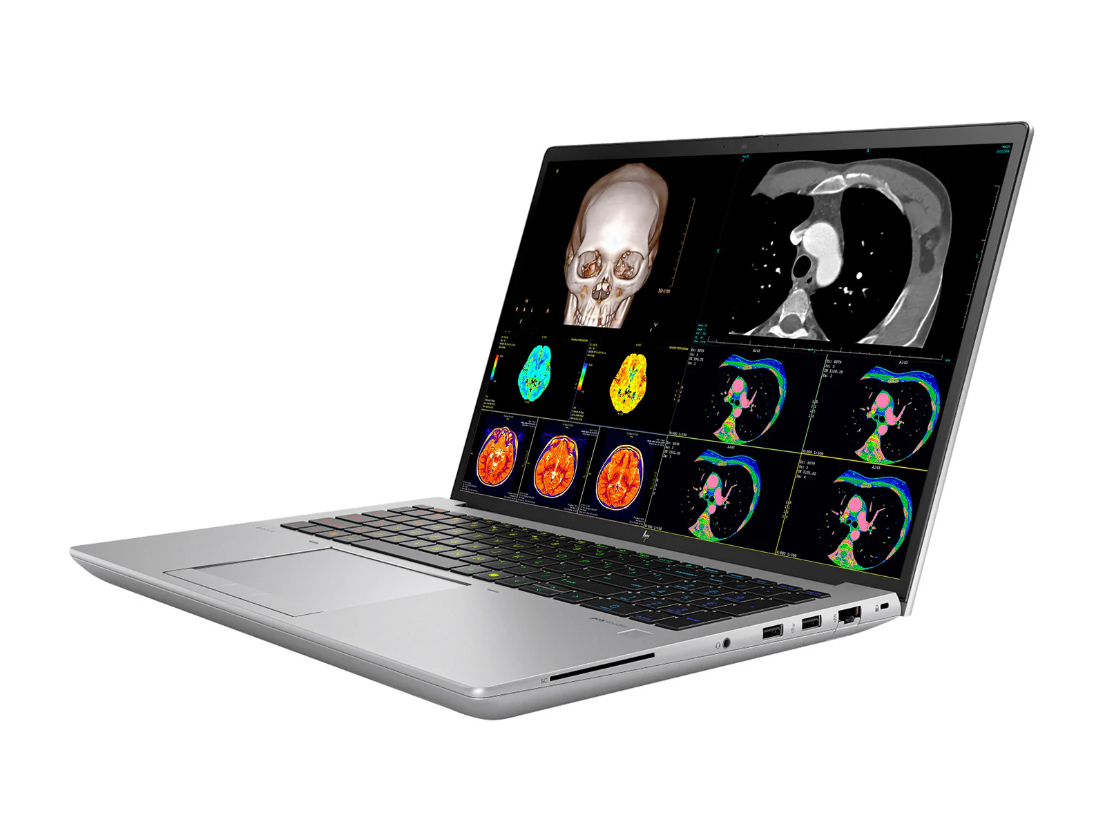 HP ZBook Fury 16 G11 Mobile Radiology Workstation | 16" OLED 9MP 4K+ UHD DICOM Calibrated | Core i9-14900HX @ 5.8GHz | 24-Core | 128GB DDR5 | 1TB NVMe SSD | RTX 2000 Ada 8GB | WiFi 6E - Image 3