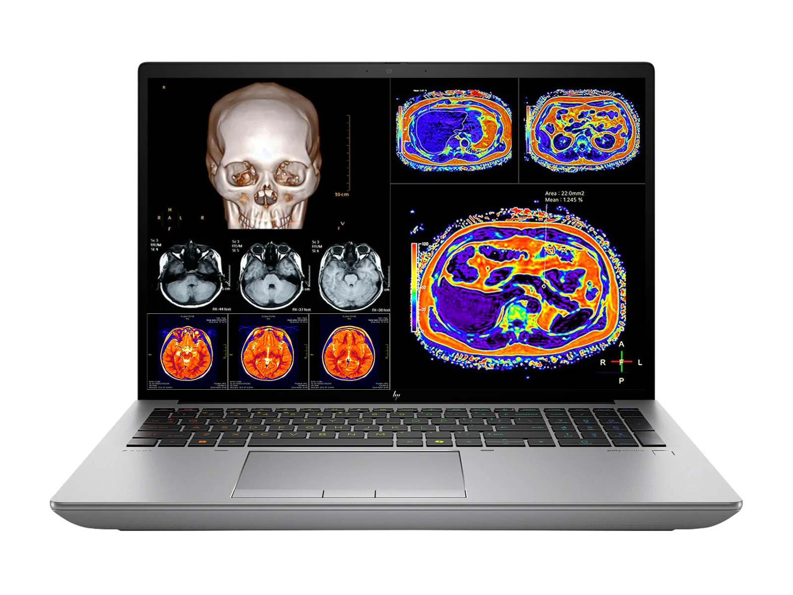 HP ZBook Fury 16 G11 Mobile Radiology Workstation | 16" 9MP 4K+ UHD DICOM Calibrated | Core i7-14700HX @ 5.5GHz | 20-Core | 128GB DDR5 | 1TB NVMe SSD | RTX 2000 Ada 8GB | WiFi 7