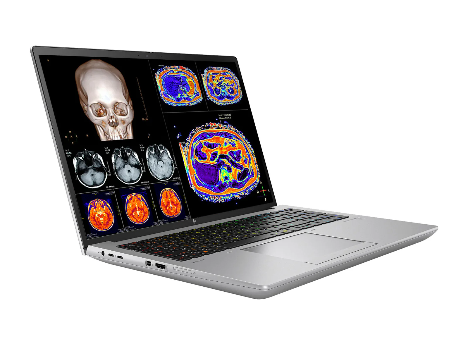 HP ZBook Fury 16 G11 Mobile Radiology Workstation | 16" 9MP 4K+ UHD DICOM Calibrated | Core i7-14700HX @ 5.5GHz | 20-Core | 128GB DDR5 | 1TB NVMe SSD | RTX 2000 Ada 8GB | WiFi 7 - Image 2