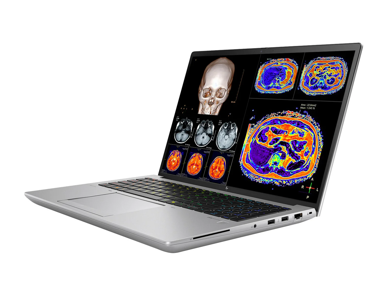 HP ZBook Fury 16 G11 Mobile Radiology Workstation | 16" 9MP 4K+ UHD DICOM Calibrated | Core i7-14700HX @ 5.5GHz | 20-Core | 128GB DDR5 | 1TB NVMe SSD | RTX 2000 Ada 8GB | WiFi 7 - Image 3