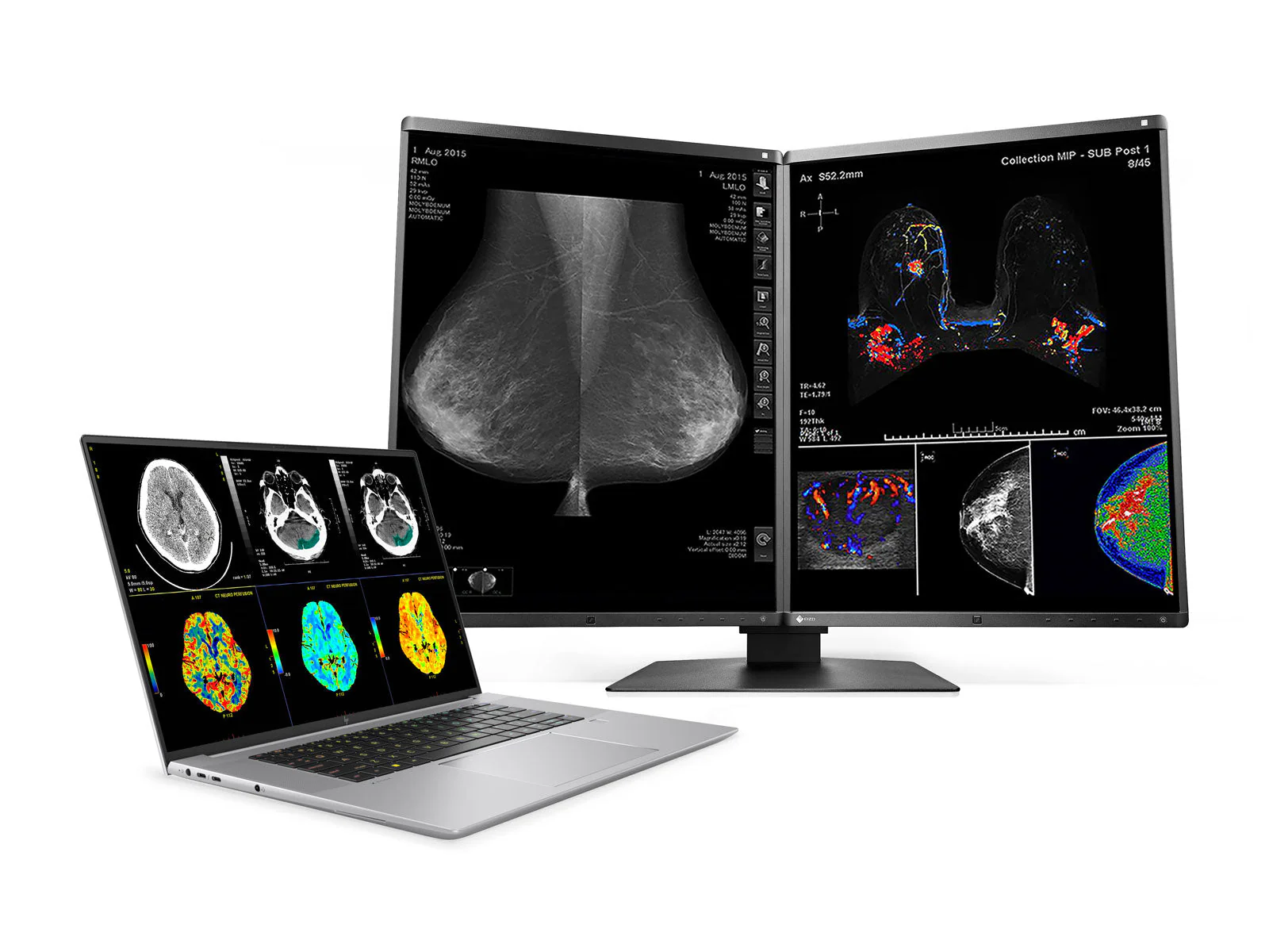 HP ZBook Studio 16 G10 Mobile Radiology Workstation | 16" 9MP 4K UHD DICOM Calibrated | Core i7-13800H @ 5.2GHz | 64GB DDR5 | 512GB NVMe SSD | NVIDIA RTX A1000 6GB - Image 3