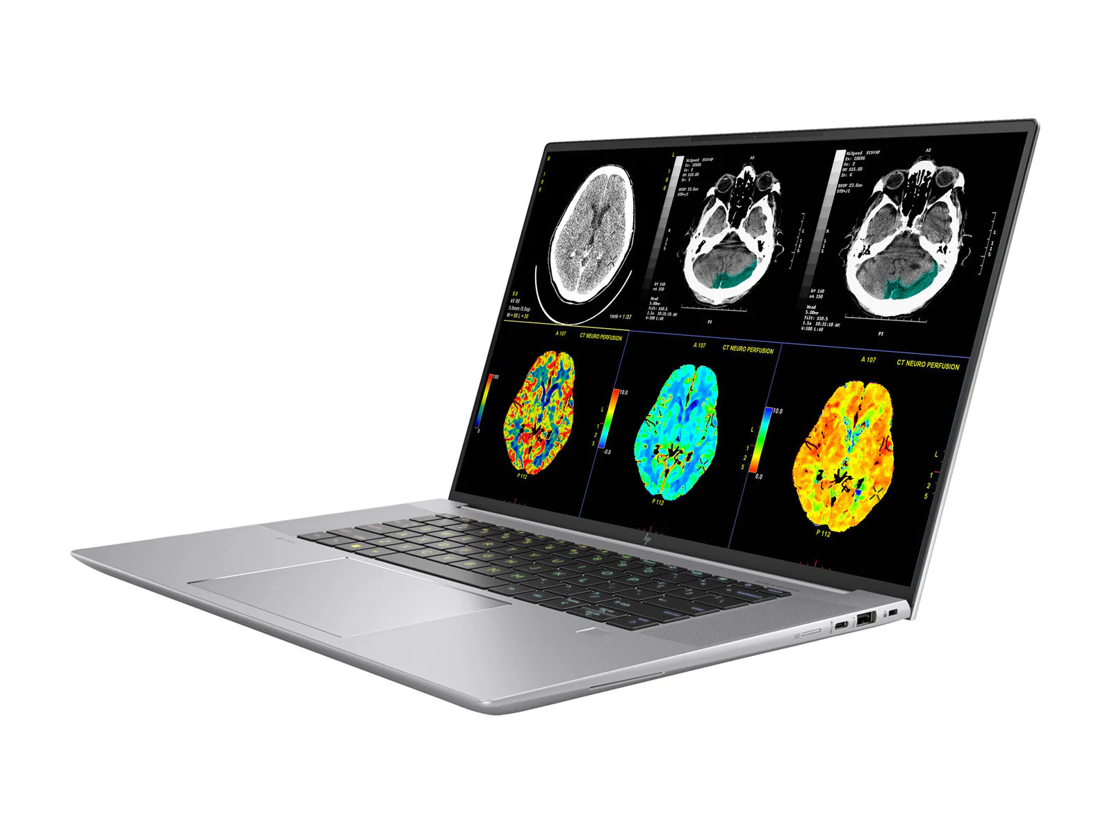 HP ZBook Studio 16 G10 Mobile Radiology Workstation | 16" 9MP 4K UHD DICOM Calibrated | Core i7-13800H @ 5.2GHz | 64GB DDR5 | 512GB NVMe SSD | NVIDIA RTX A1000 6GB - Image 4