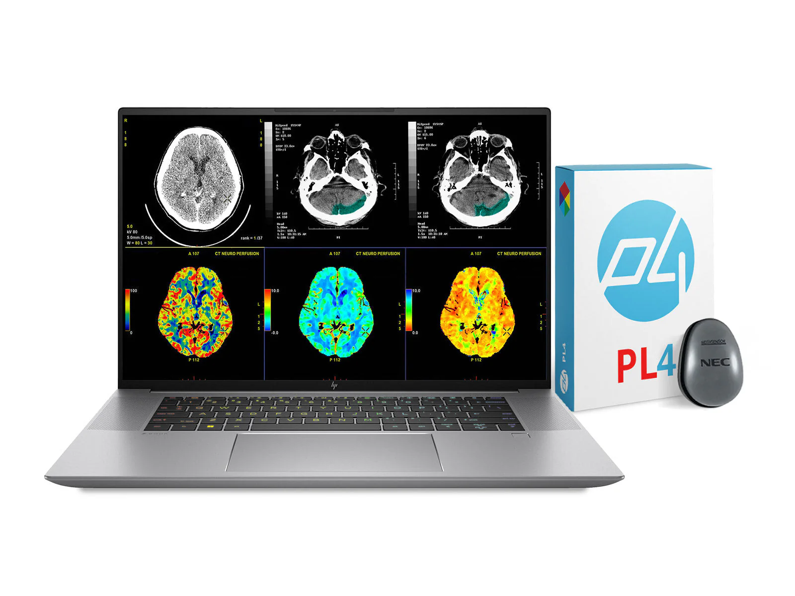 HP ZBook Studio 16 G10 Mobile Radiology Workstation | 16" 9MP 4K UHD DICOM Calibrated | Core i7-13800H @ 5.2GHz | 64GB DDR5 | 512GB NVMe SSD | NVIDIA RTX A1000 6GB - Image 9