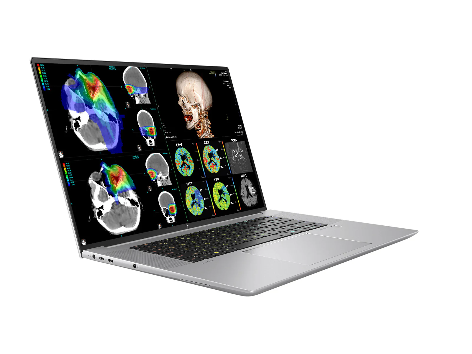 HP ZBook Studio 16 G11 Mobile Radiology Workstation | 16" 9MP 4K+ UHD DICOM Calibrated | Intel Core Ultra 7 155H @ 4.8GHz | 16-core | 32GB DDR5 | 1TB NVMe SSD | RTX 2000 ada 8GB | WiFi 6E - Image 2