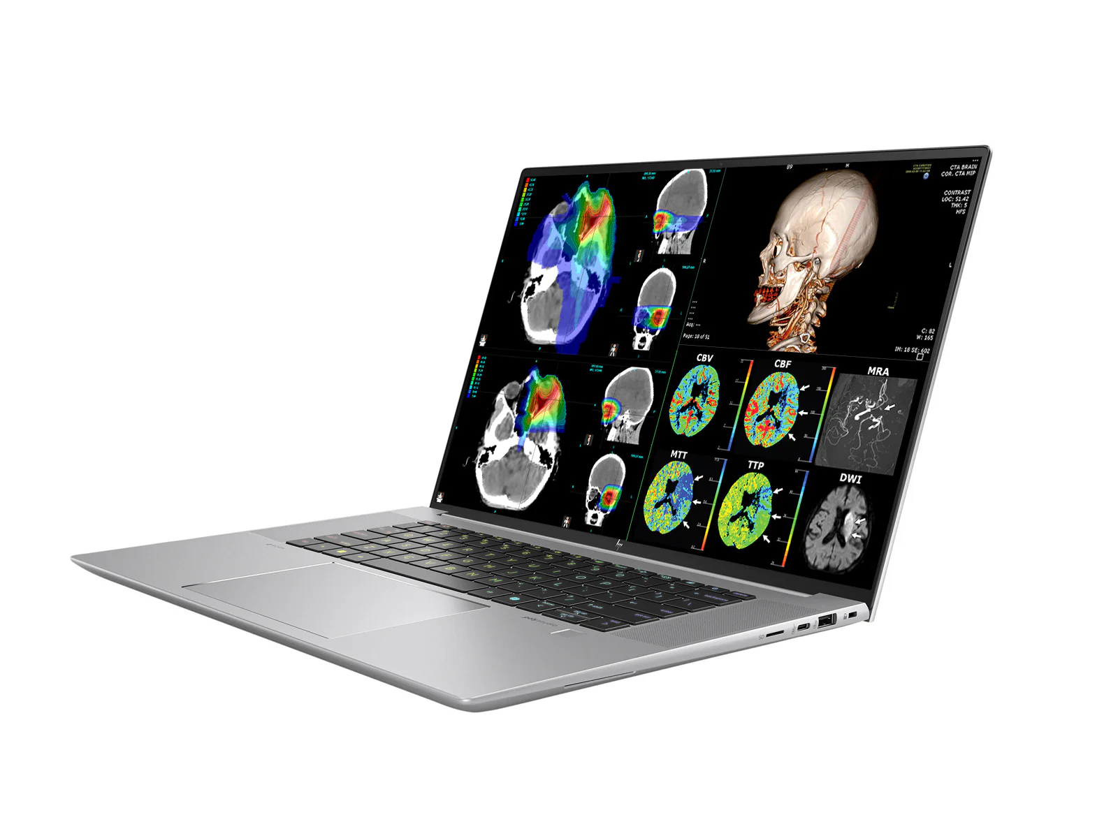 HP ZBook Studio 16 G11 Mobile Radiology Workstation | 16" 9MP 4K+ UHD DICOM Calibrated | Intel Core Ultra 7 155H @ 4.8GHz | 16-core | 32GB DDR5 | 1TB NVMe SSD | RTX 2000 ada 8GB | WiFi 6E - Image 3