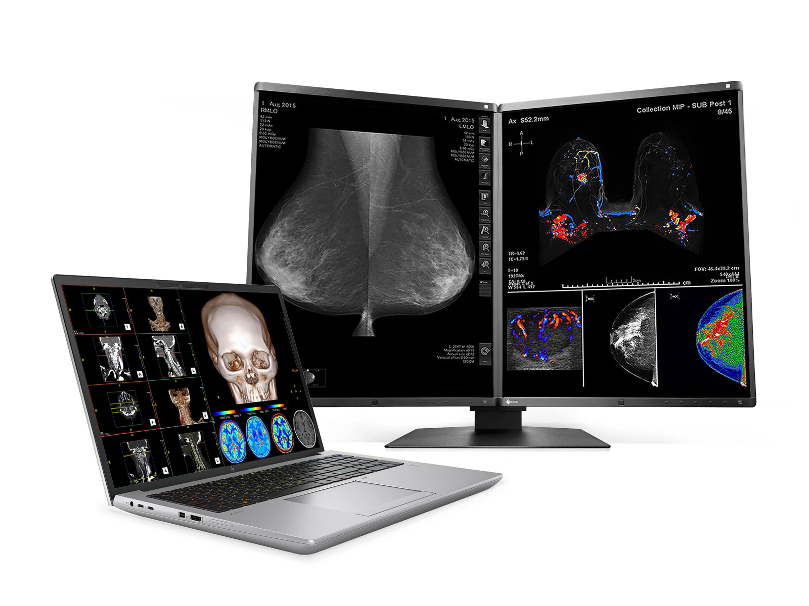 HP ZBook Fury 16 G10 Mobile Radiology Workstation | 16" OLED 9MP 4K+ UHD DICOM Calibrated | Core i7-13850HX @ 5.30GHz | 20-Core | 32GB DDR5 | 1TB NVMe SSD | RTX 5000 Ada 16GB | WiFi 6E - Image 3