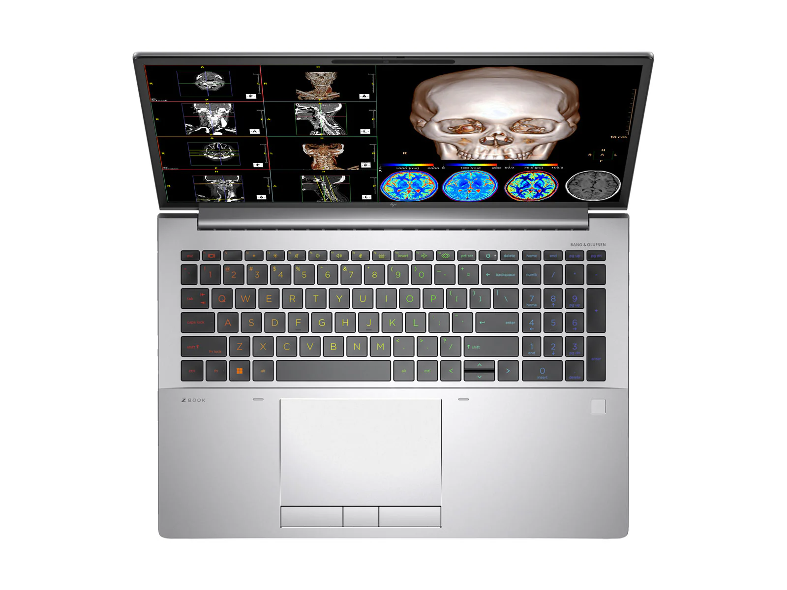 HP ZBook Fury 16 G10 Mobile Radiology Workstation | 16" OLED 9MP 4K+ UHD DICOM Calibrated | Core i7-13850HX @ 5.30GHz | 20-Core | 32GB DDR5 | 1TB NVMe SSD | RTX 5000 Ada 16GB | WiFi 6E - Image 4