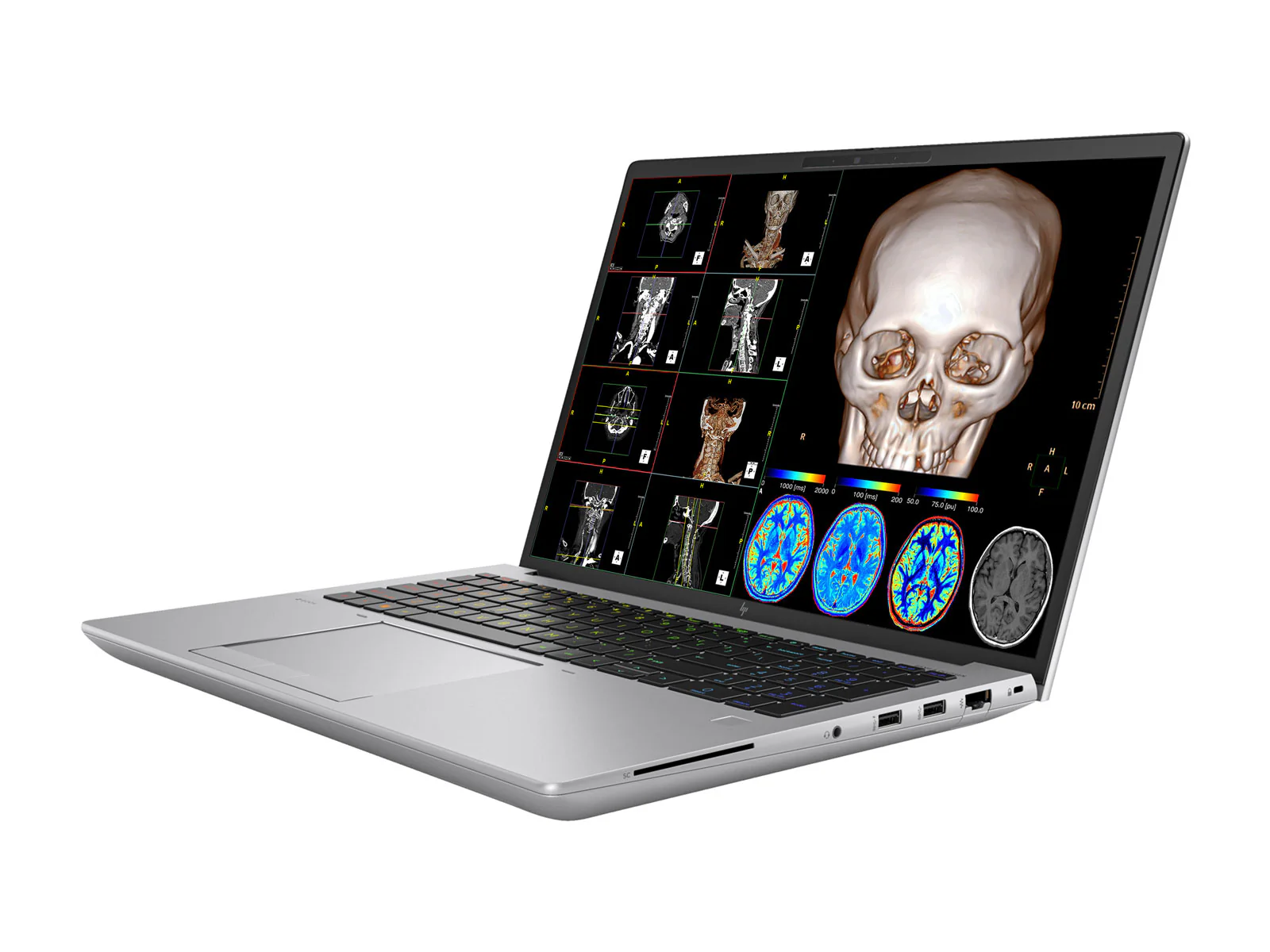 HP ZBook Fury 16 G10 Mobile Radiology Workstation | 16" OLED 9MP 4K+ UHD DICOM Calibrated | Core i7-13850HX @ 5.30GHz | 20-Core | 32GB DDR5 | 1TB NVMe SSD | RTX 5000 Ada 16GB | WiFi 6E - Image 5