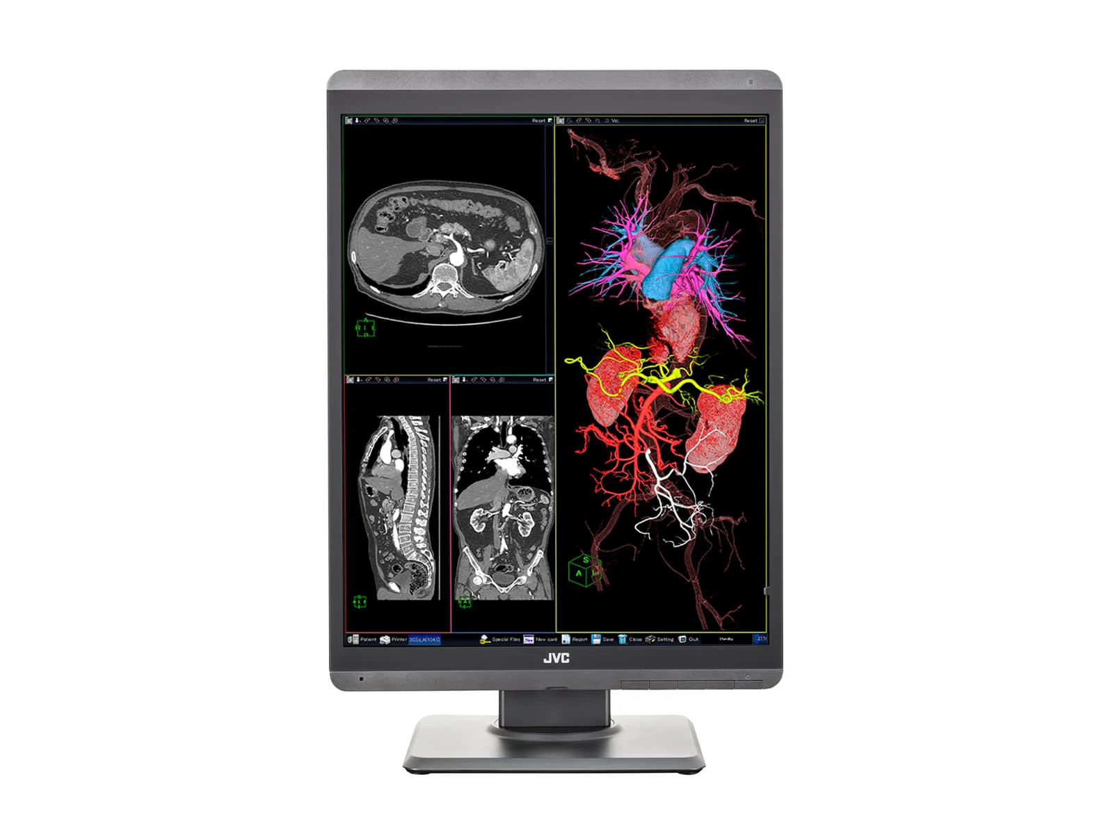 JVC Totoku CL-S200 2MP 21" Color PACS Display Monitor (CL-S200) - Image 4