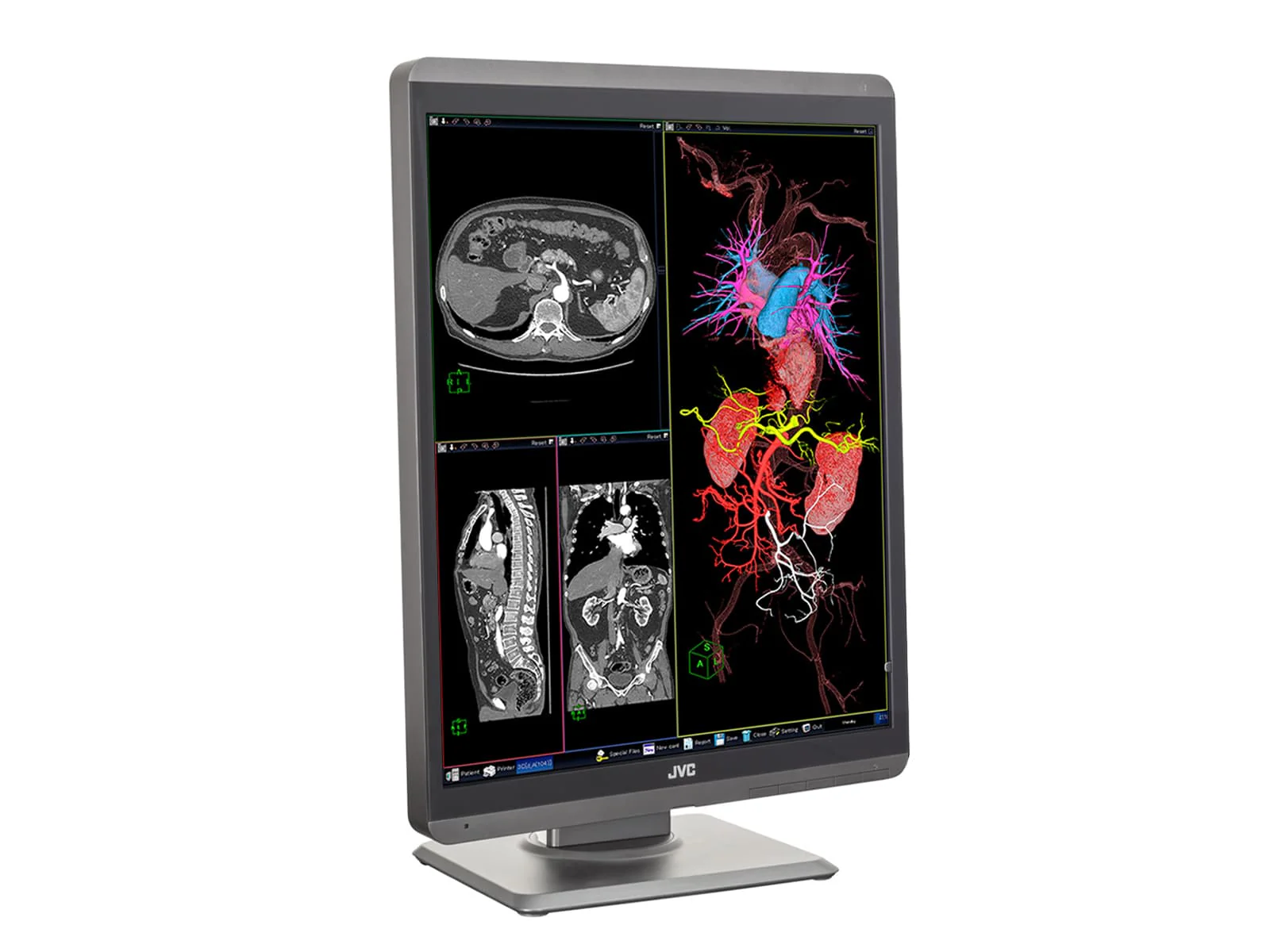 JVC Totoku CL-S200 2MP 21" Color PACS Display Monitor (CL-S200) - Image 5
