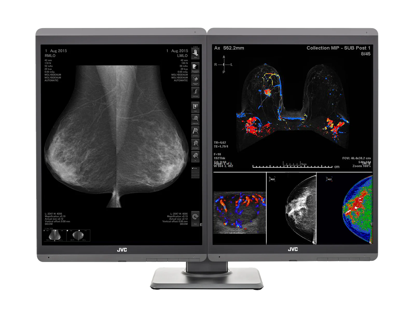 JVC Totoku CL-S500 5MP 21" Color Mammo 3D-DBT Breast Imaging Display (CL-S500) - Image 12