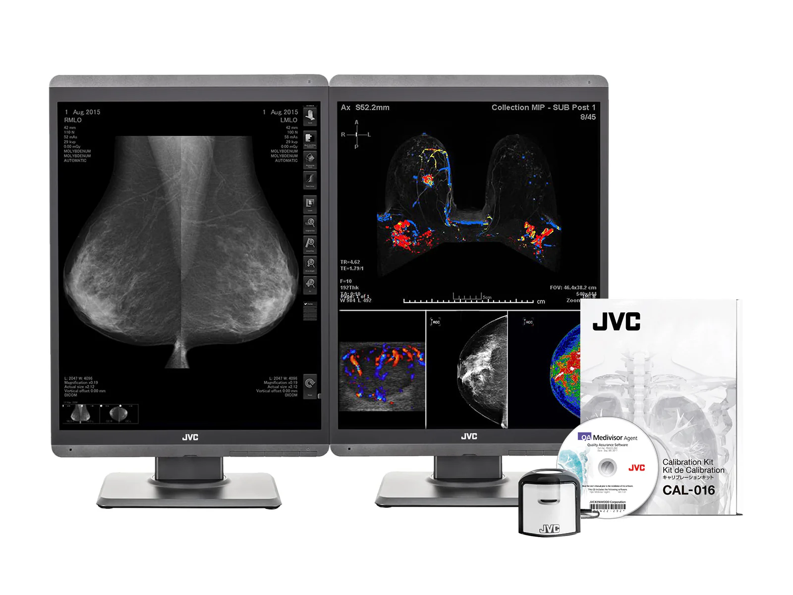 Pair (x2) JVC Totoku CL-S500 5MP 21" Color Mammo 3D-DBT Breast Imaging Display (CL-S500) - Image 2