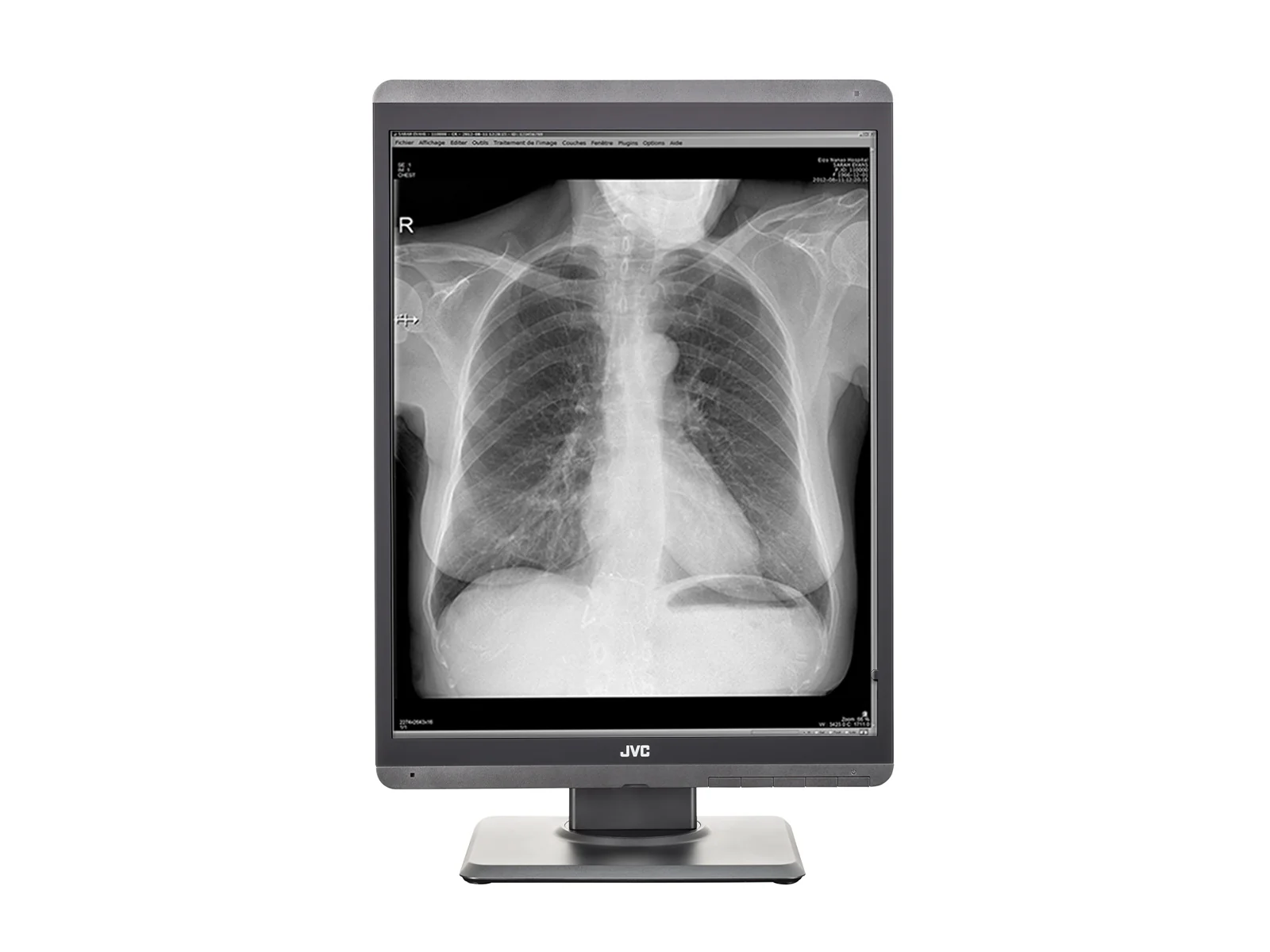 JVC Totoku MS-S200 2MP 21" Grayscale Diagnostic Radiology Display Monitor (MS-S200) - Image 4