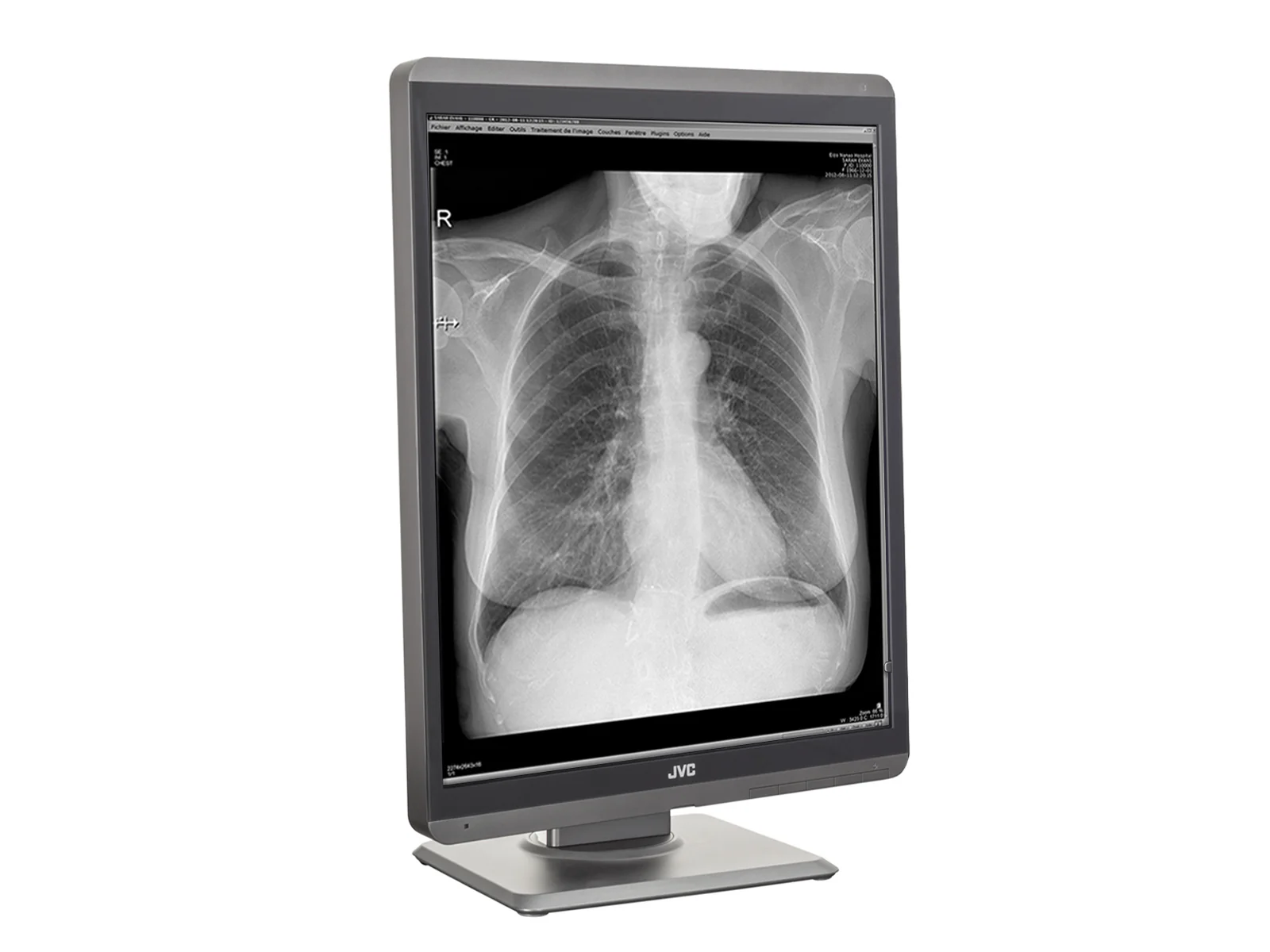 JVC Totoku MS-S200 2MP 21" Grayscale Diagnostic Radiology Display Monitor (MS-S200) - Image 6