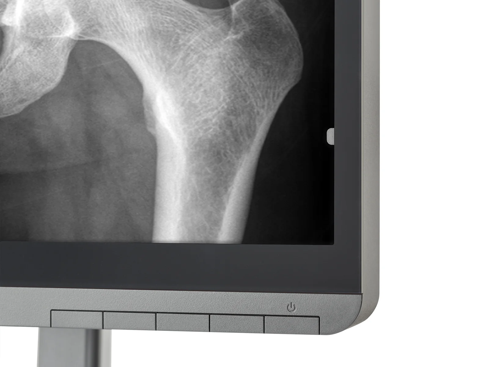JVC Totoku MS-S200 2MP 21" Grayscale Diagnostic Radiology Display Monitor (MS-S200) - Image 8