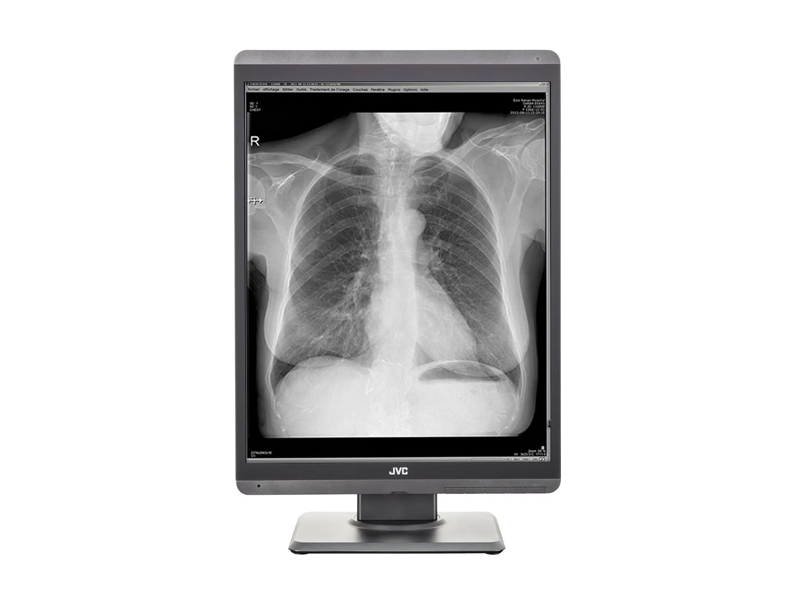 JVC Totoku MS-S300 3MP 21" Grayscale General Radiology Diagnostic Display Monitor (MS-S300) - Image 4