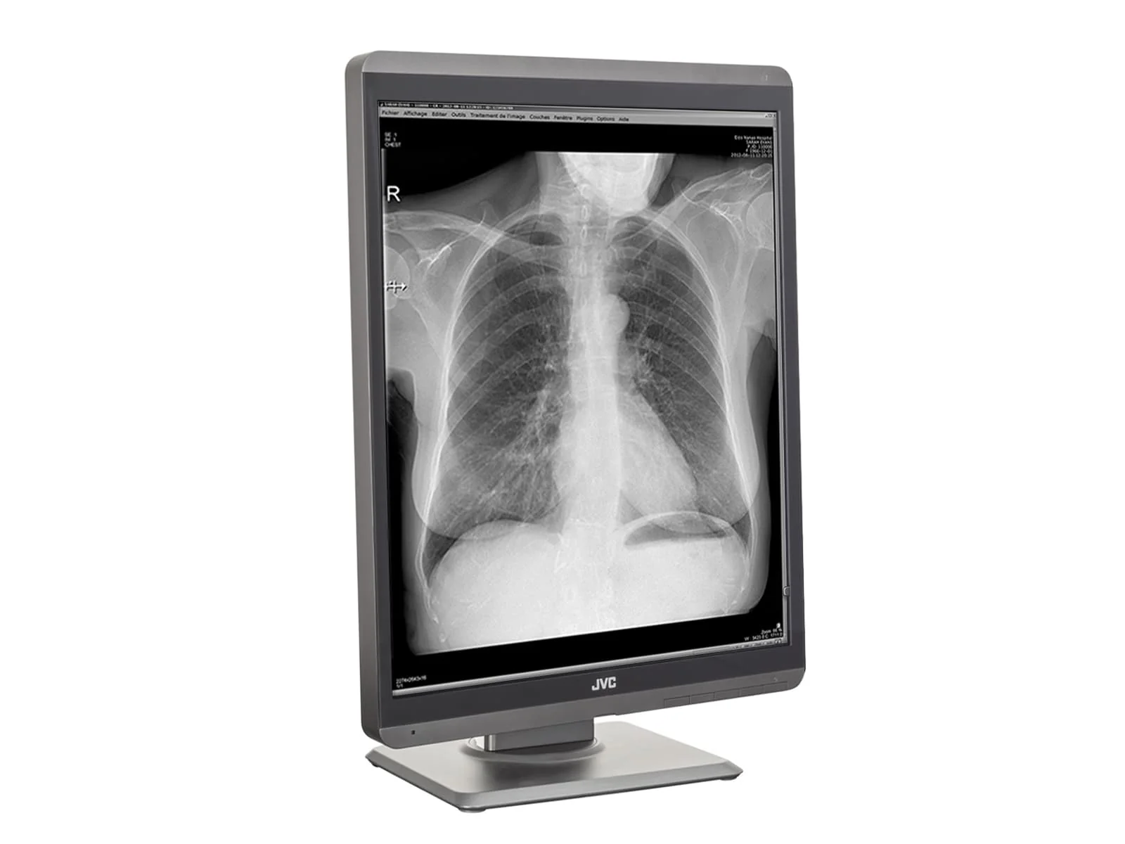 JVC Totoku MS-S300 3MP 21" Grayscale General Radiology Diagnostic Display Monitor (MS-S300) - Image 5