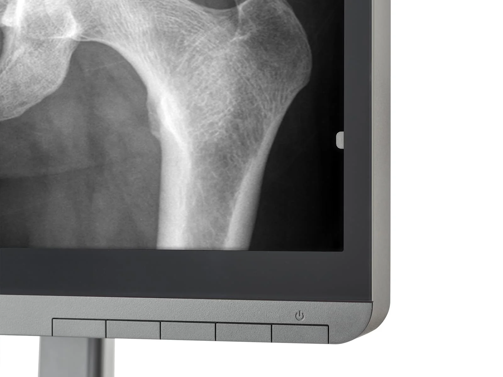 JVC Totoku MS-S300 3MP 21" Grayscale General Radiology Diagnostic Display Monitor (MS-S300) - Image 8