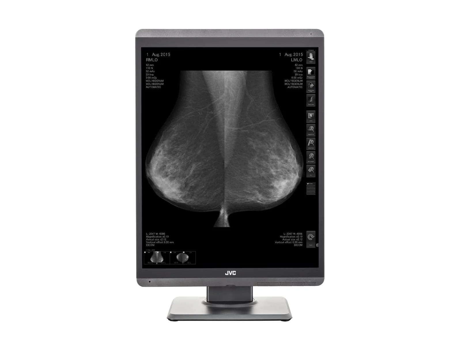JVC Totoku MS-S500 5MP 21" Mammo 3D-DBT Grayscale Breast Imaging Display (MS-S500) - Image 4