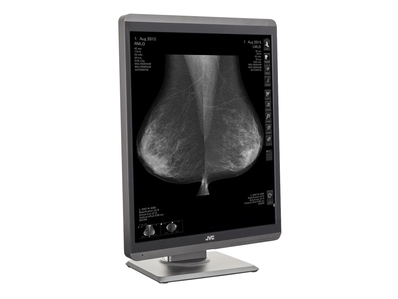 JVC Totoku MS-S500 5MP 21" Mammo 3D-DBT Grayscale Breast Imaging Display (MS-S500) - Image 5