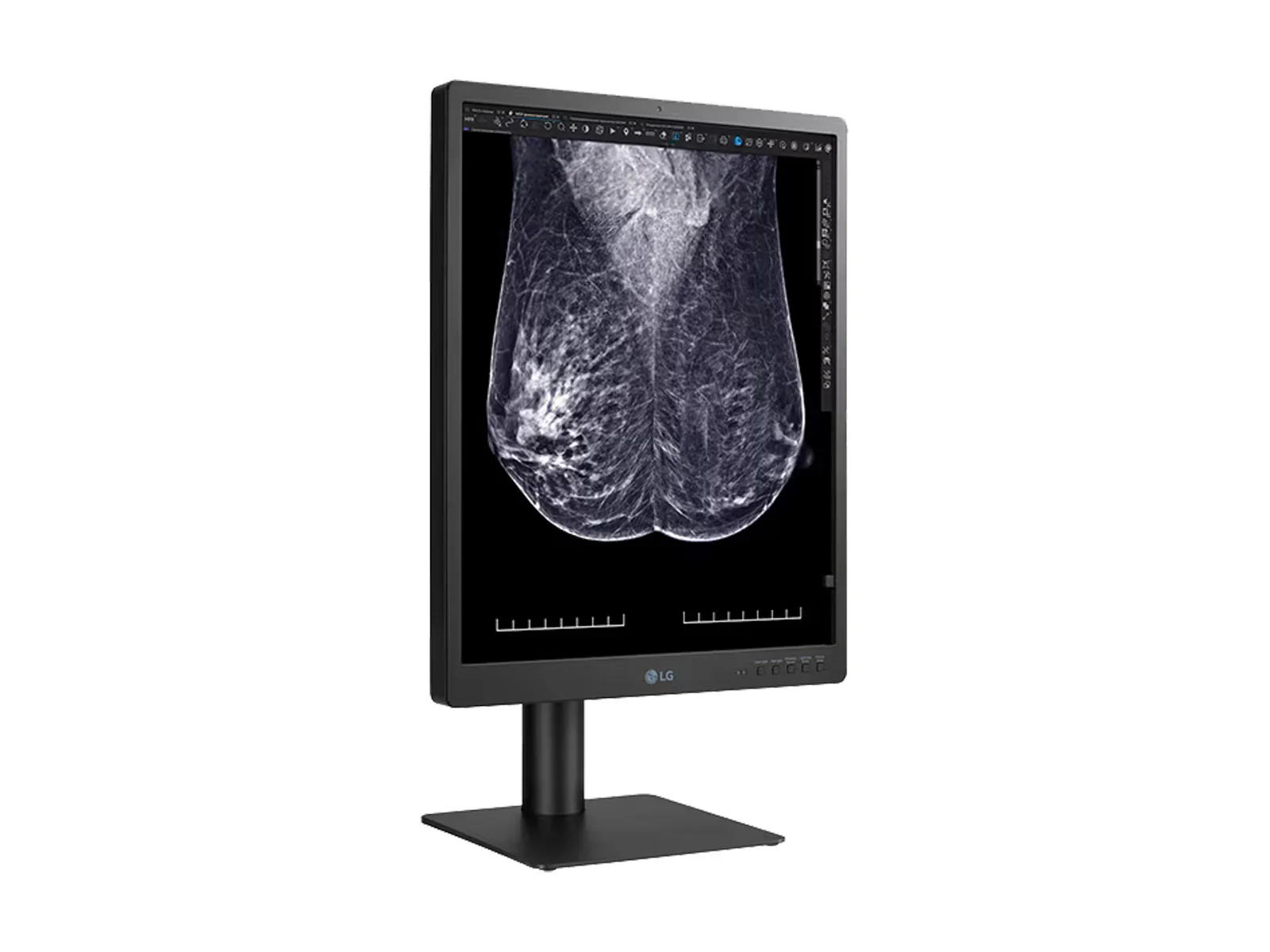 LG 5MP 21" 21HQ613D-B Color Mammography 3D-Tomosynthesis Breast Imaging Display Monitor - Image 10