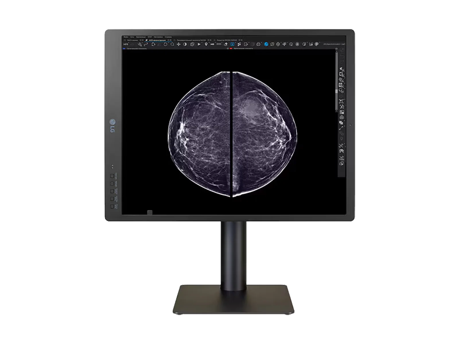 LG 5MP 21" 21HQ613D-B Color Mammography 3D-Tomosynthesis Breast Imaging Display Monitor - Image 12