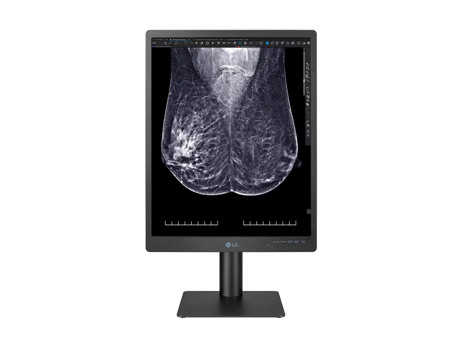 LG 5MP 21" 21HQ613D-B Color Mammography 3D-Tomosynthesis Breast Imaging Display Monitor - Image 2