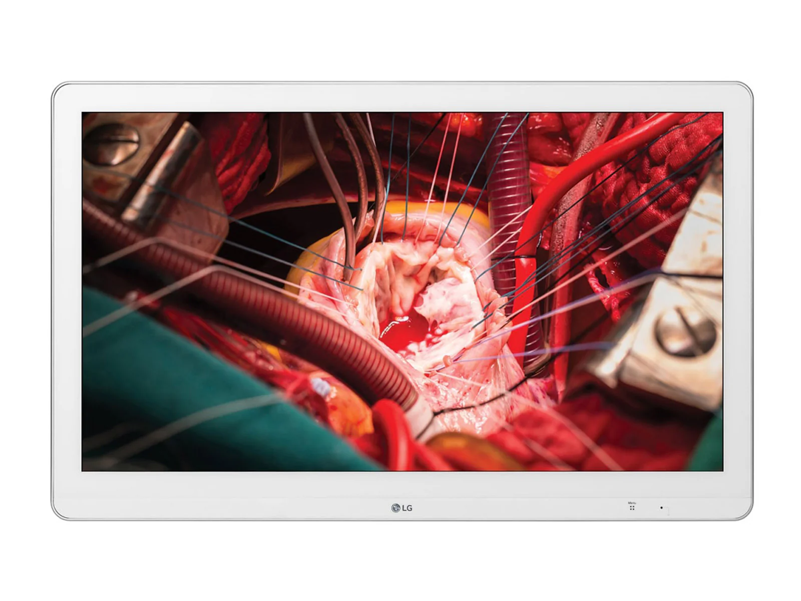 LG 27'' 27HK510S-W Full HD 2MP IPS 3G-SDI Surgical Endoscopy Medical Display Monitor