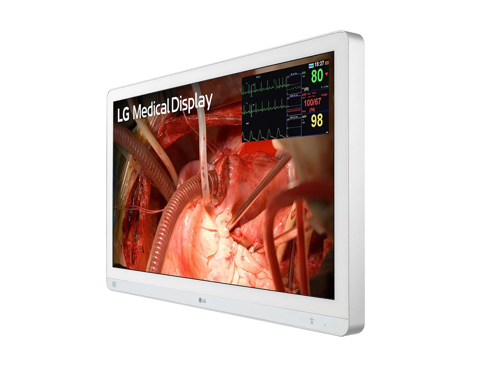 LG 27" 27HQ710S-W 4K Mini-LED 3G SDI Surgical Endoscopy Medical Display Monitor - Image 2