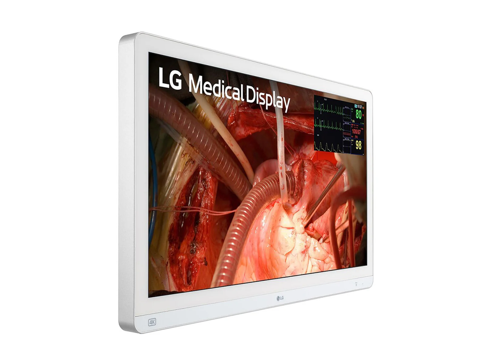 LG 27" 27HQ710S-W 4K Mini-LED 3G SDI Surgical Endoscopy Medical Display Monitor - Image 3