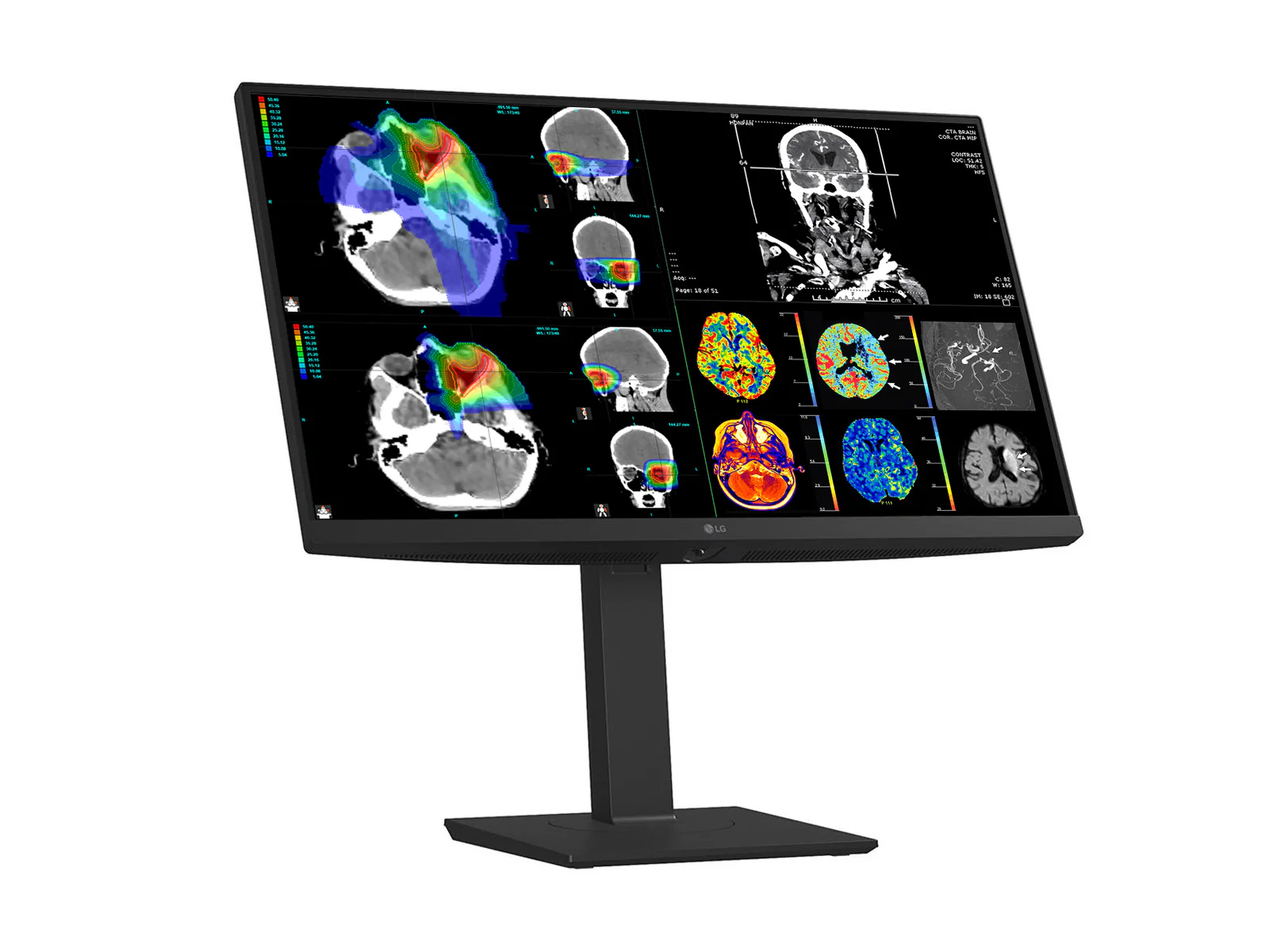 LG 27" 27HS713C Fusion 8MP 4K Clinical Review Medical DICOM Display Monitor - Image 3