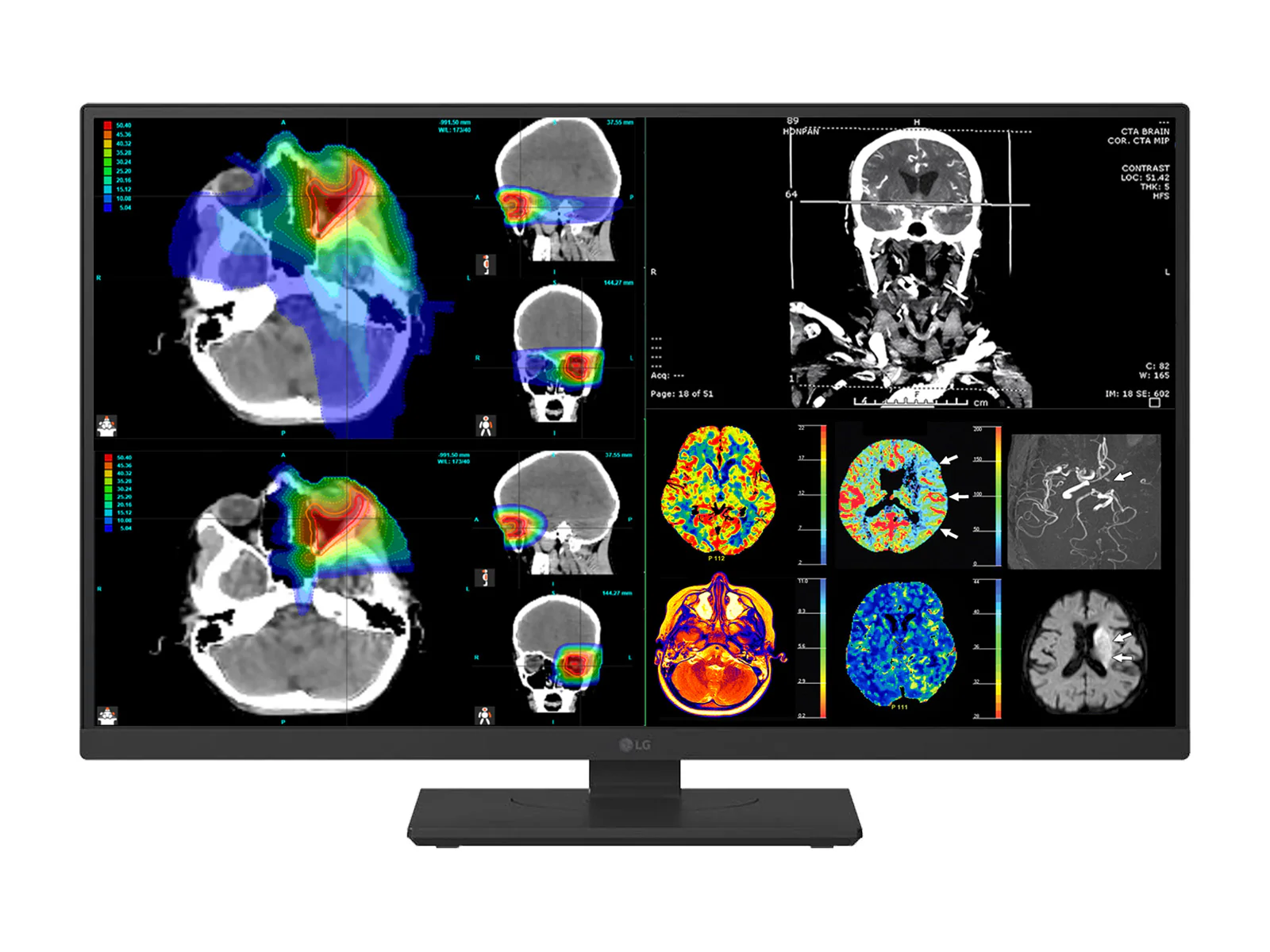LG 27" 27HS713C Fusion 8MP 4K Clinical Review Medical DICOM Display Monitor - Image 4
