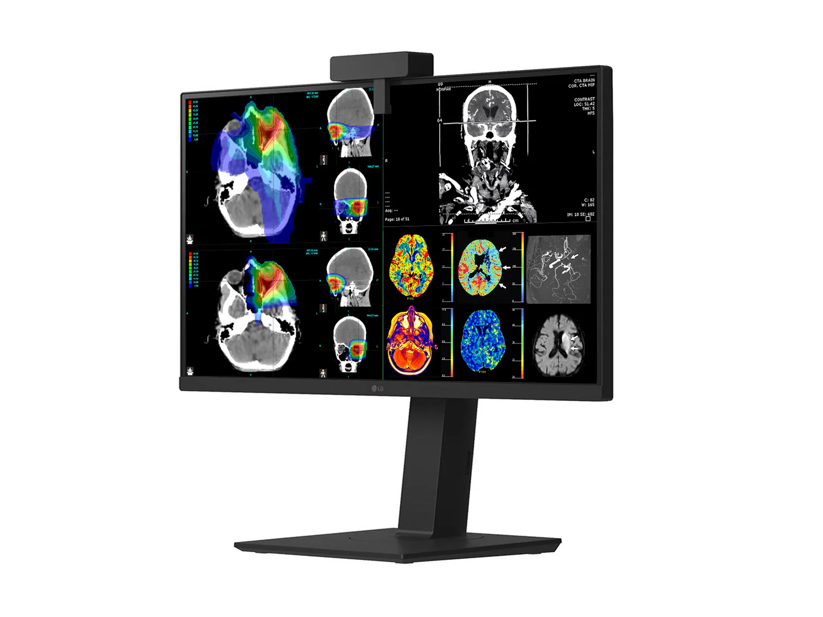 LG 27" 27HS713C Fusion 8MP 4K Clinical Review Medical DICOM Display Monitor - Image 5